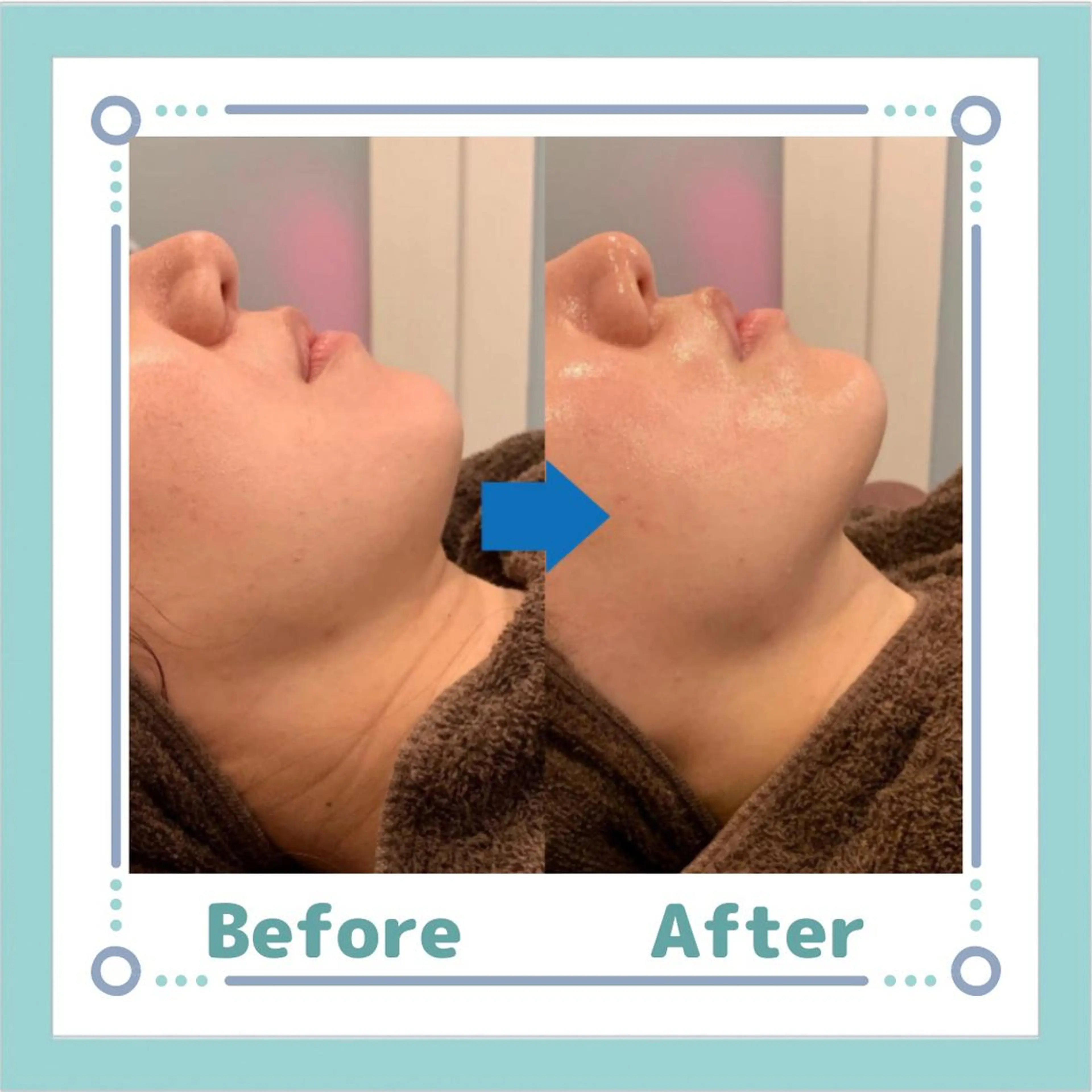 小顔痩身インディバ Nana表参道のエステ・リラクイメージ