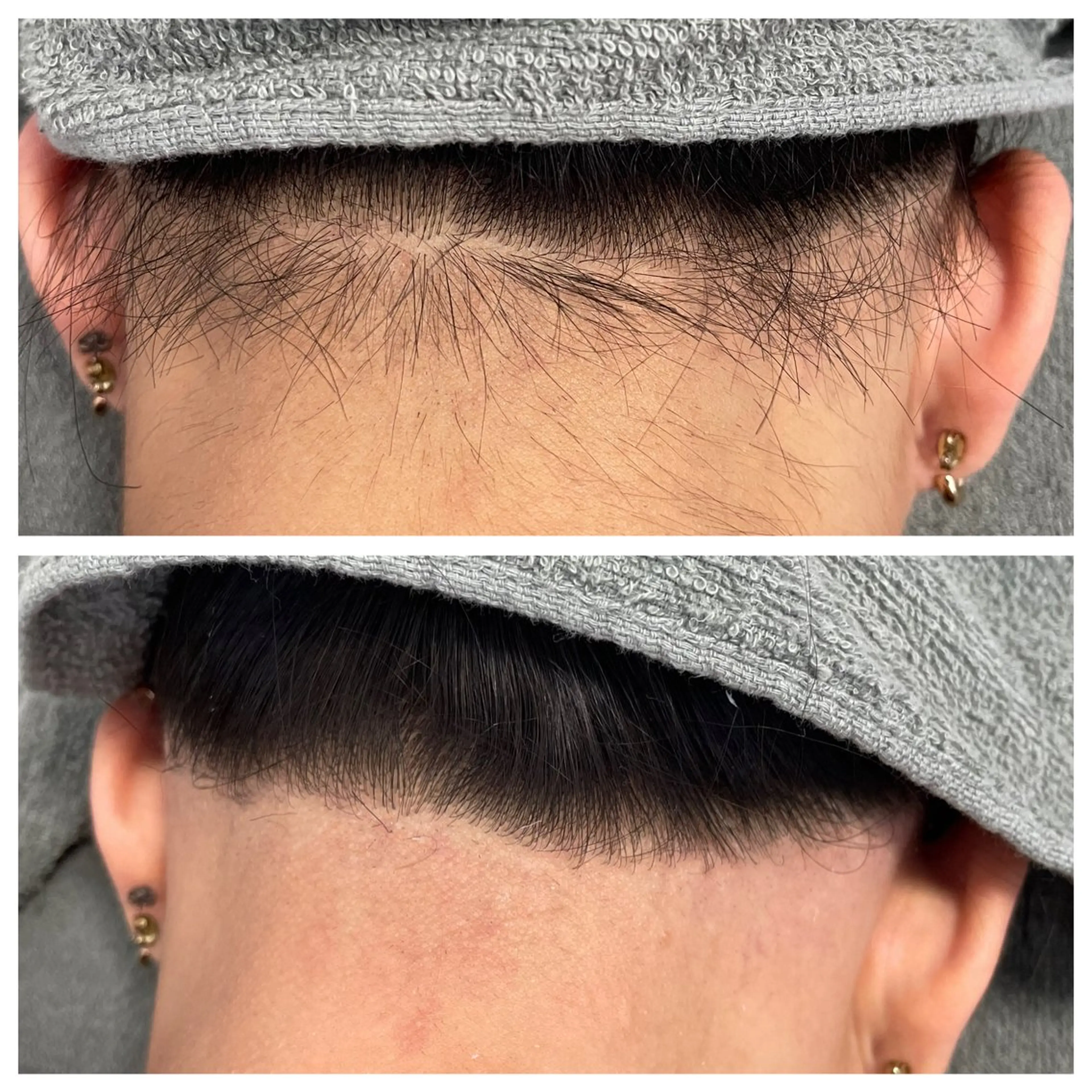 脱毛 Salon Improveのネイルデザイン