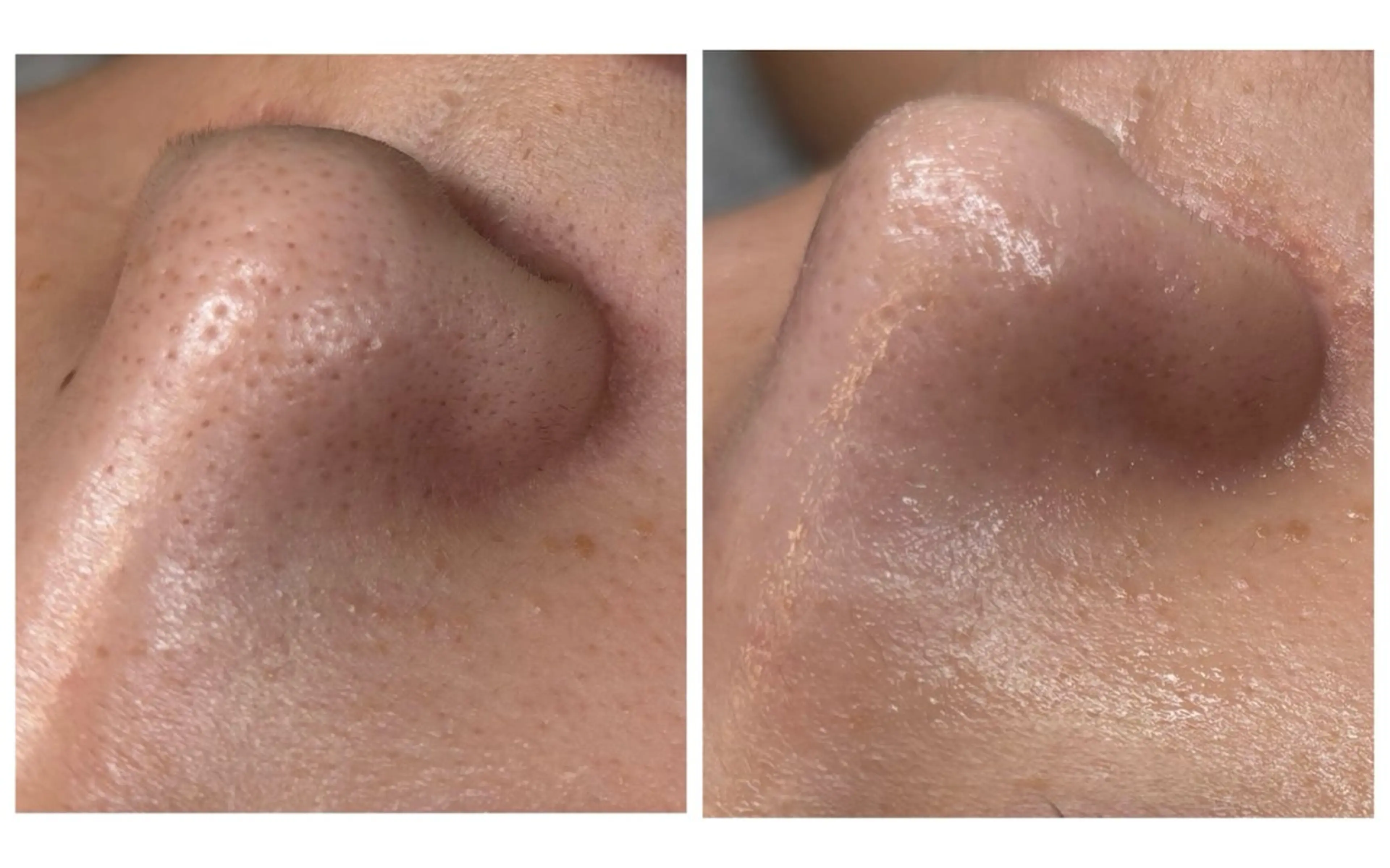 ワックス脱毛 Salon【yuzu.】所属・肌管理×美眉 【yuzu.】のその他イメージ