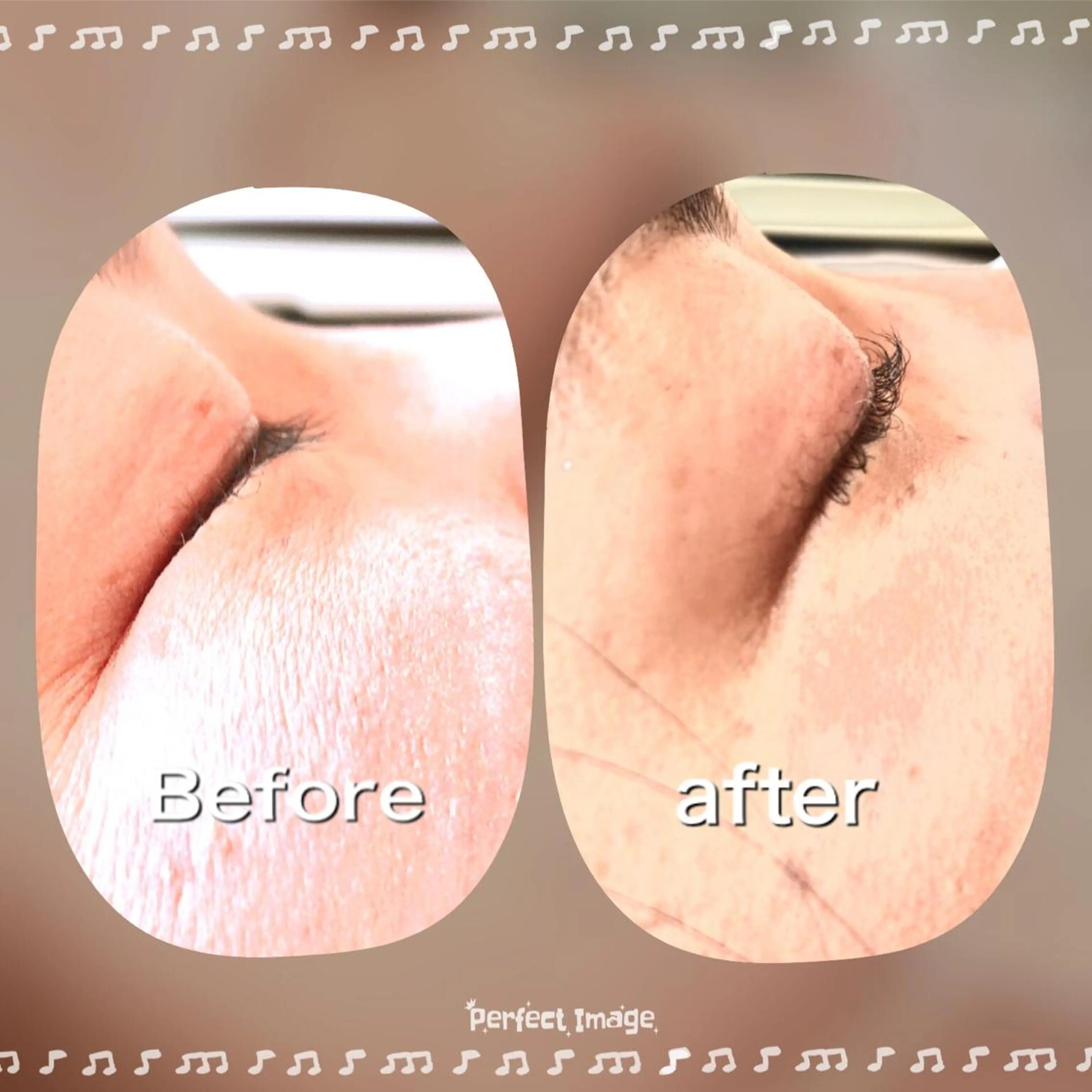 マツエク・マツパ loisir yamanoのマツエク・マツパデザイン