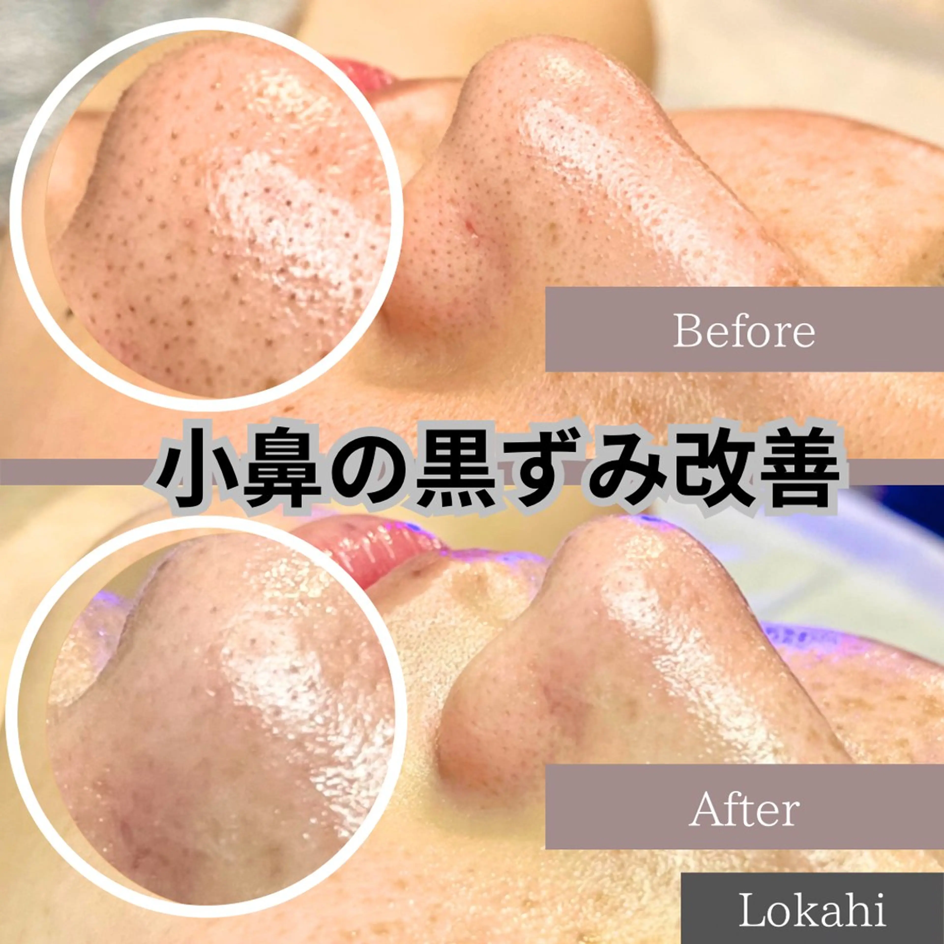 エステ Lokahi所属・脱毛/エステ/水光肌 Lokahiのエステ・リラクイメージ