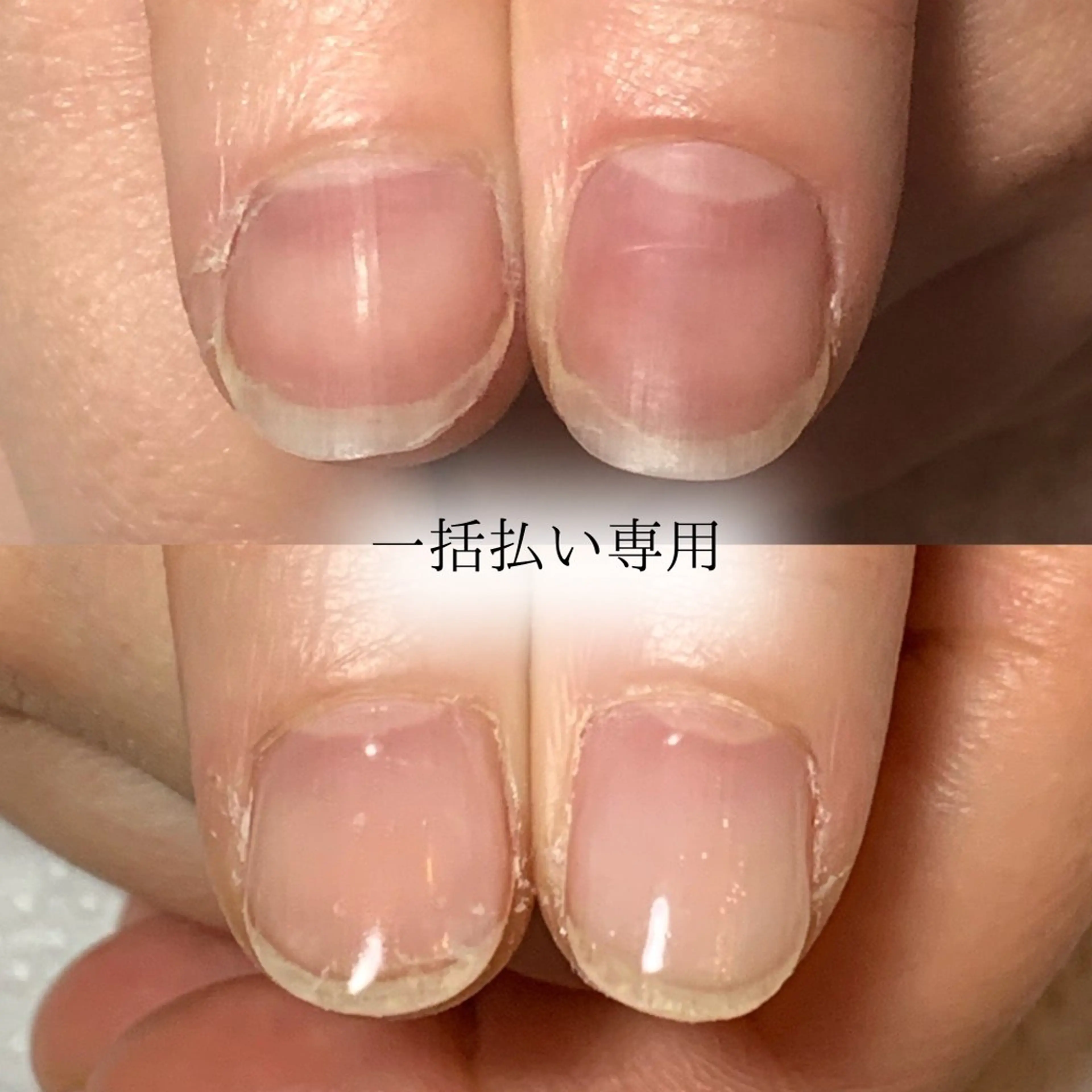 【トップコートでピンクの部分を伸ばす】自爪育成コース🎁ご新規様ホームケアセットプレゼント🎁の写真