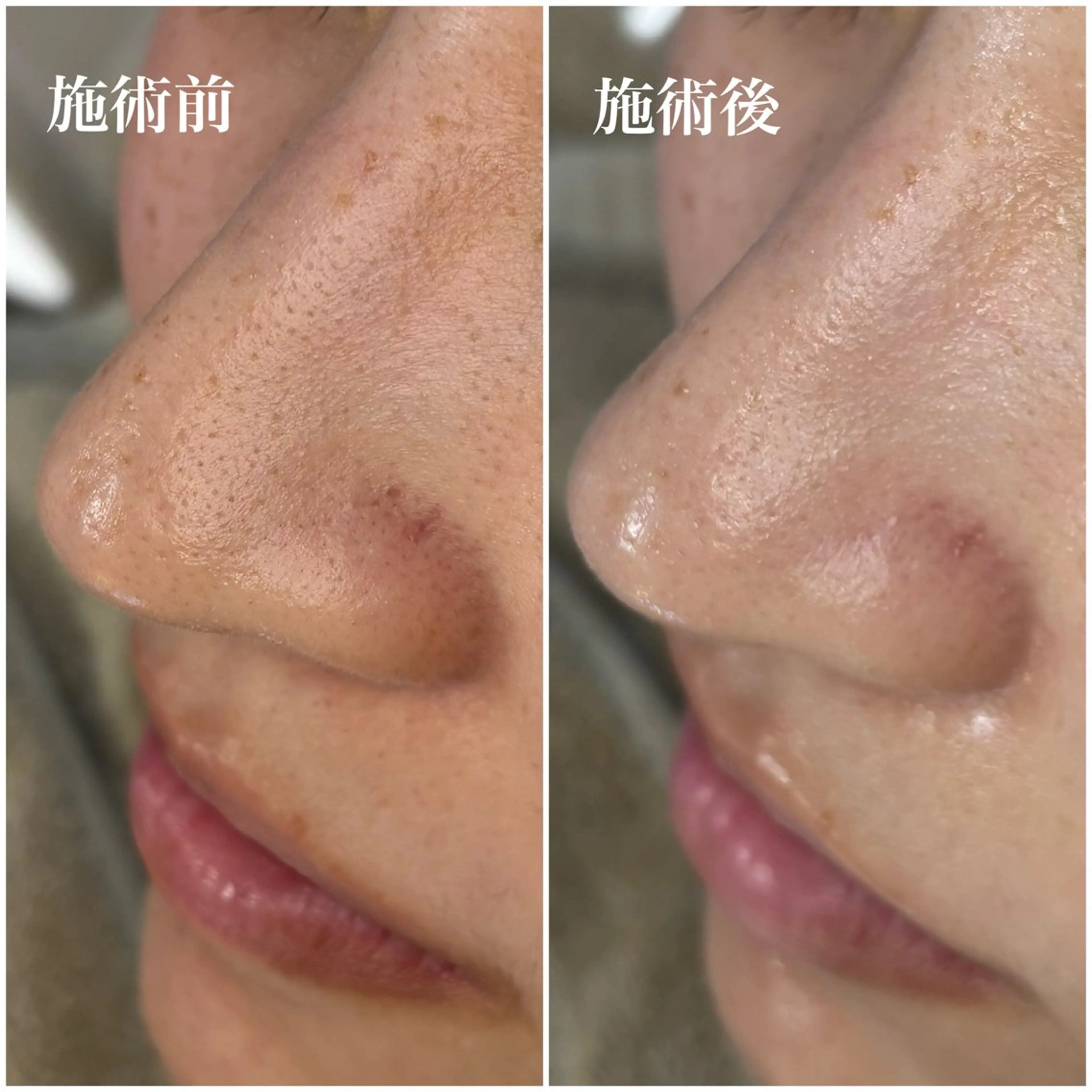 毛穴専門店アイミュー mamiのエステ・リラクイメージ