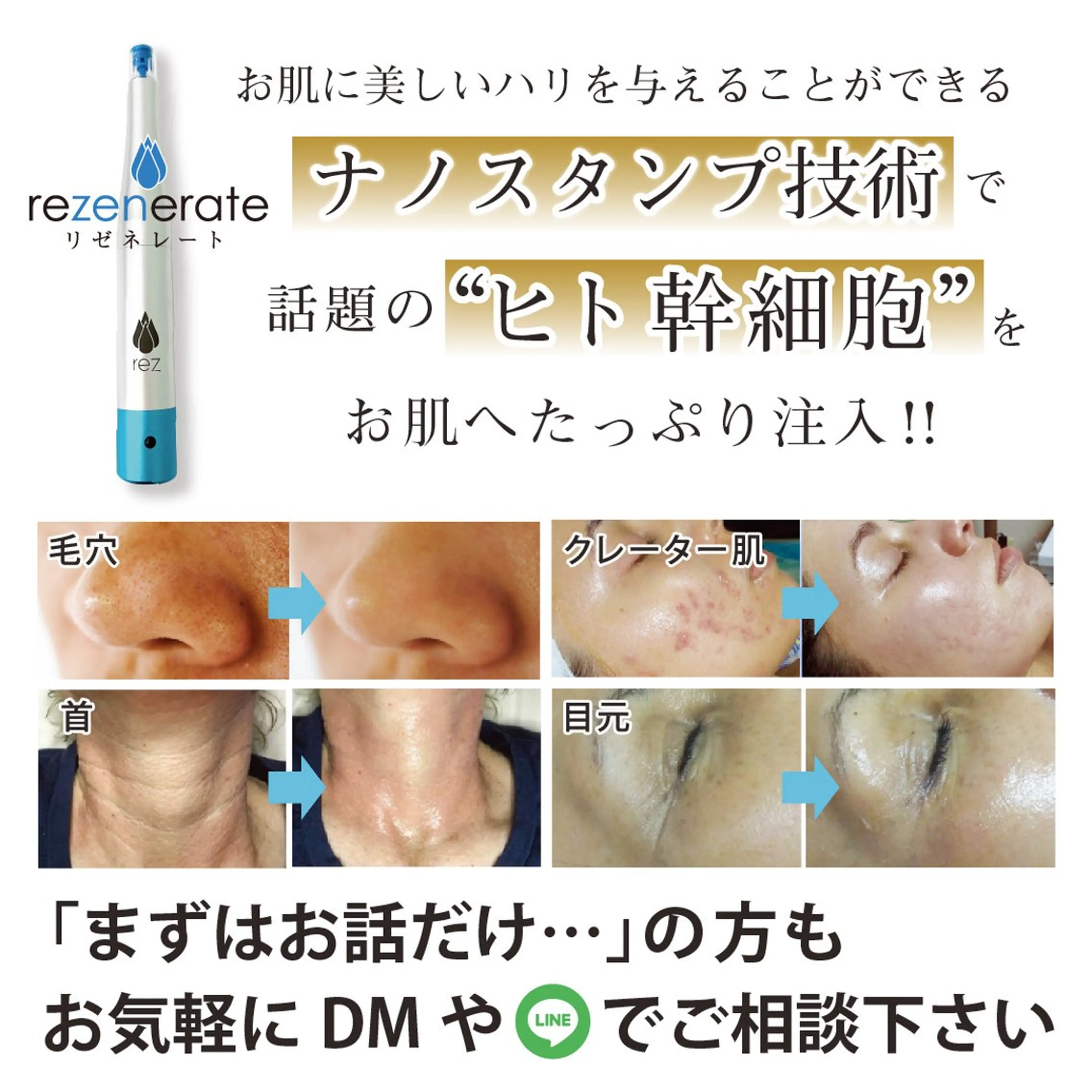 エステ Rifuro毛穴ケア &よもぎ蒸しサロンのエステ・リラクイメージ