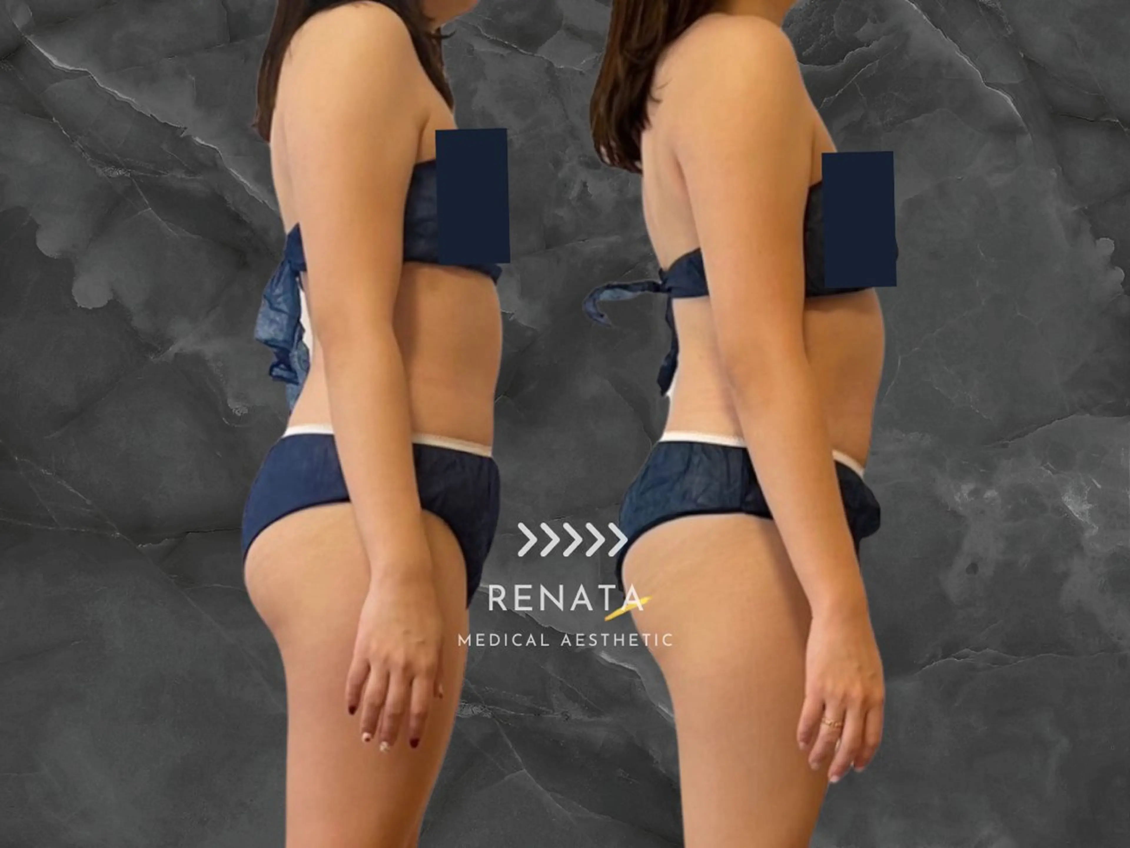 RENATA🕊 脂肪冷却専門店六本木のエステ・リラクイメージ