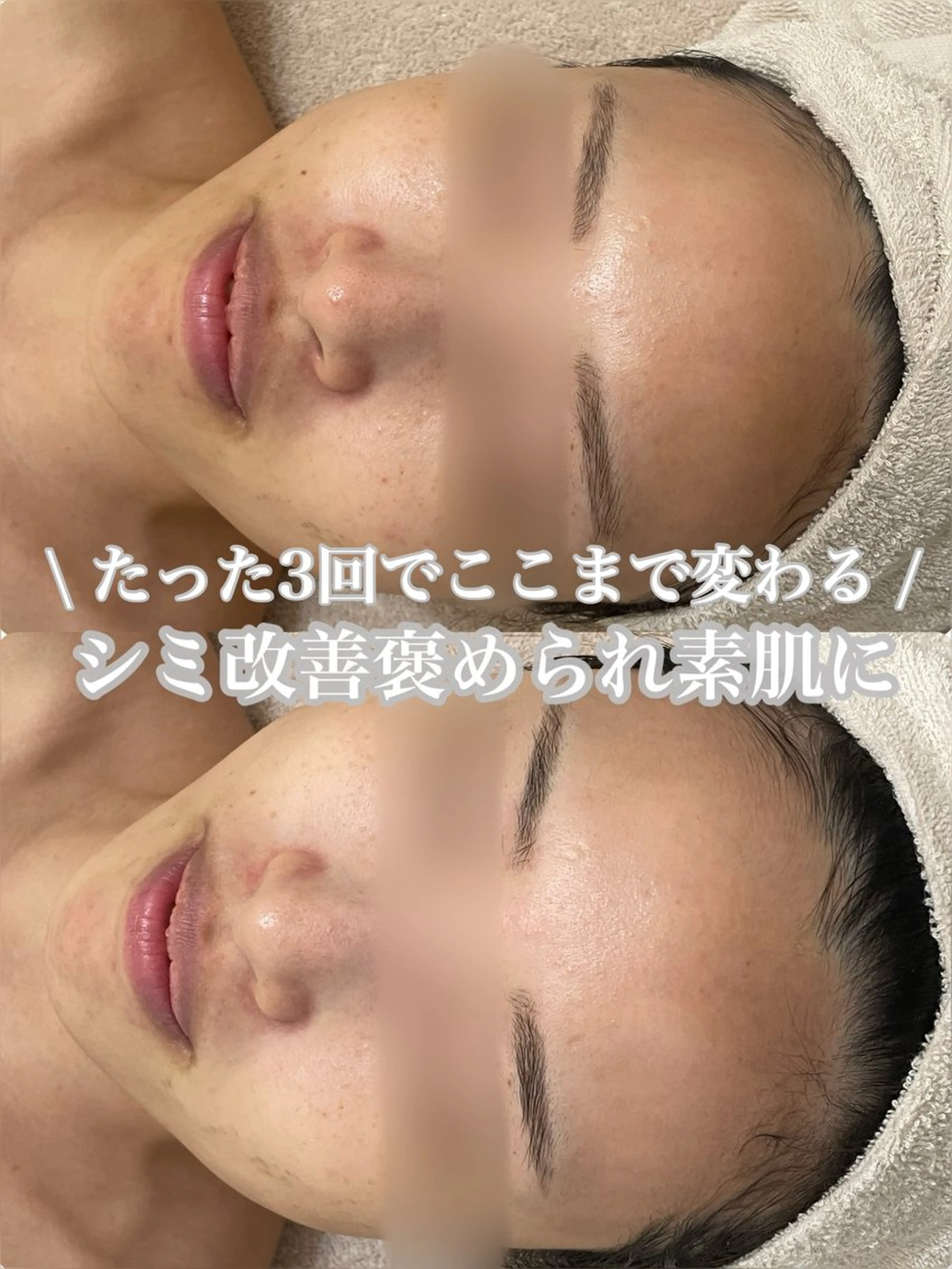 大阪/高槻　salon me.所属・仲原 杏菜のエステ・リラクイメージ