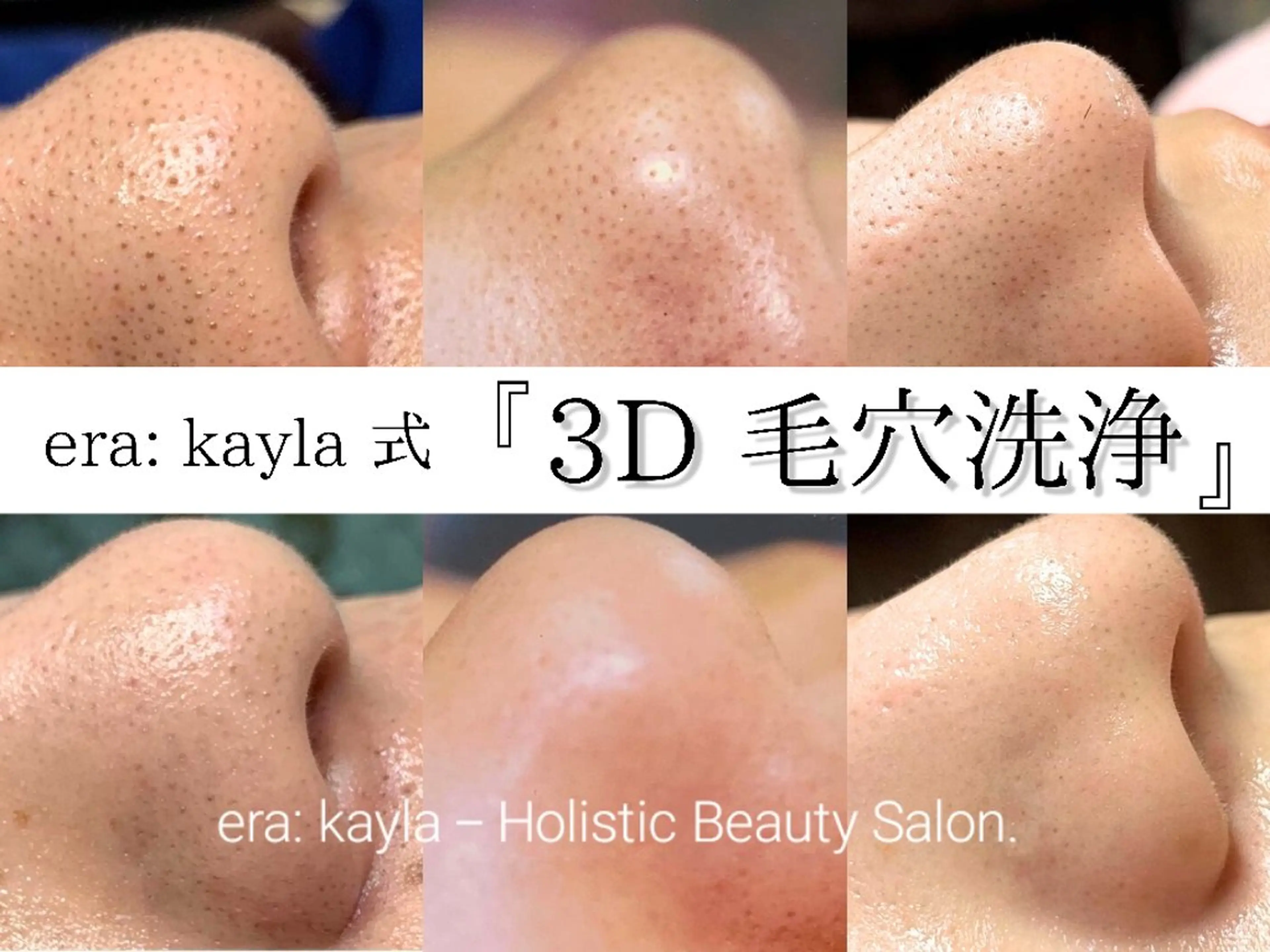 era: kayla 毛穴・ニキビ改善のエステ・リラクイメージ