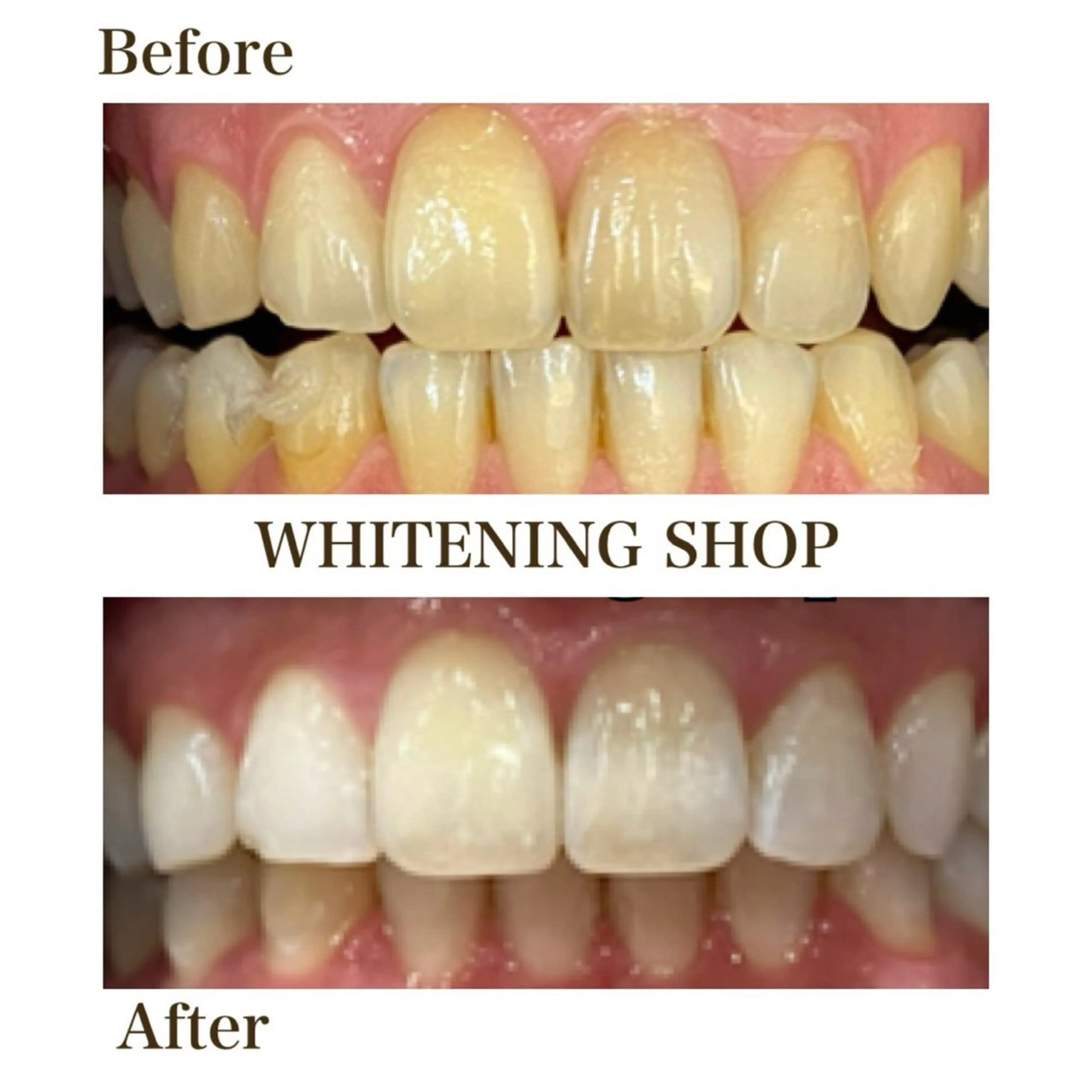 その他 ホワイトニングショップ静岡葵区店所属・ホワイトニング ショップ静岡葵区店のその他イメージ