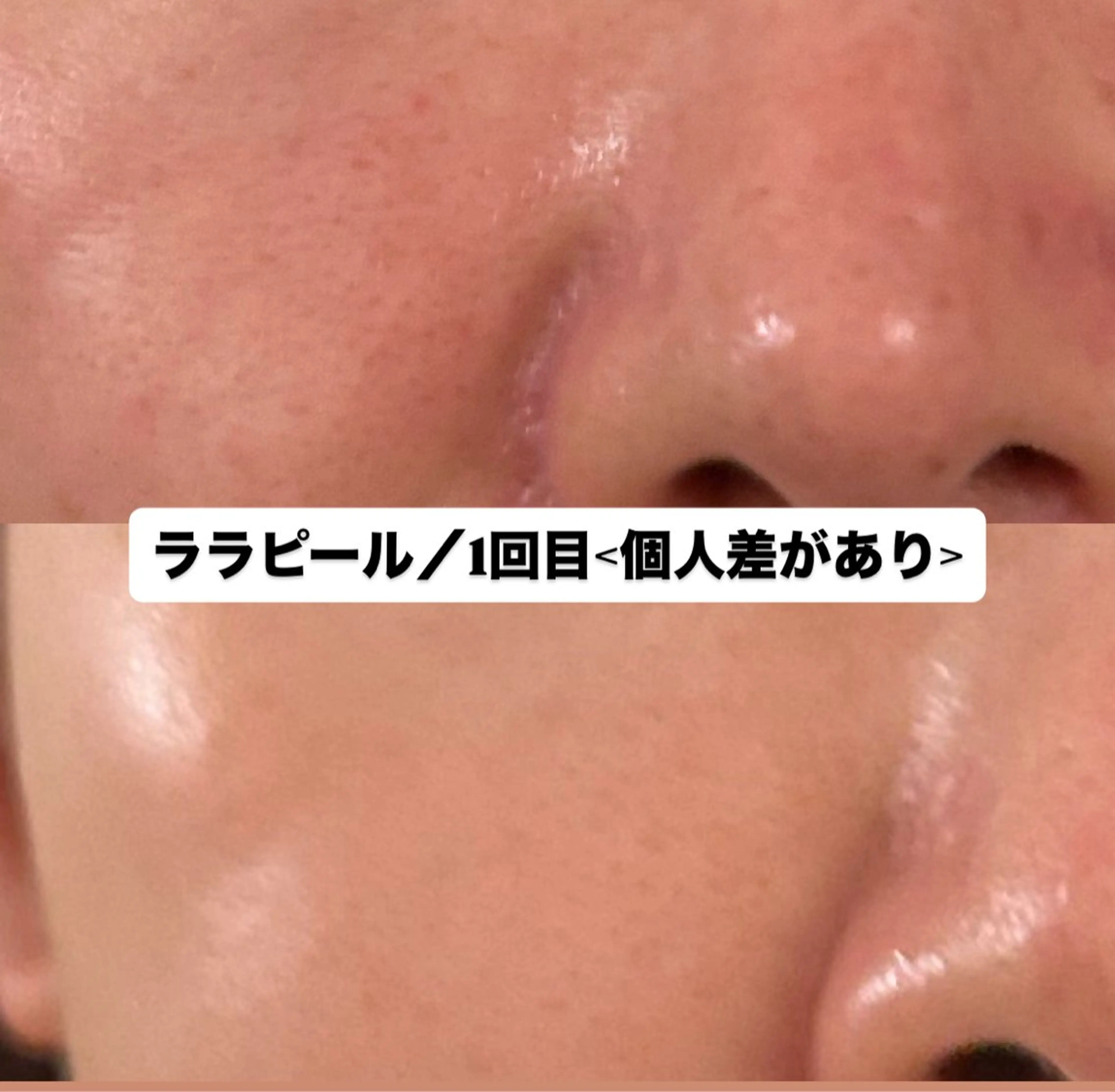 エステ リラク 【ハイパーナイフ痩身&小顔コルギ&ハーブピーリング】K-Beauty　東新宿所属・kーbeauty痩身 フェイシャルのエステ・リラクイメージ