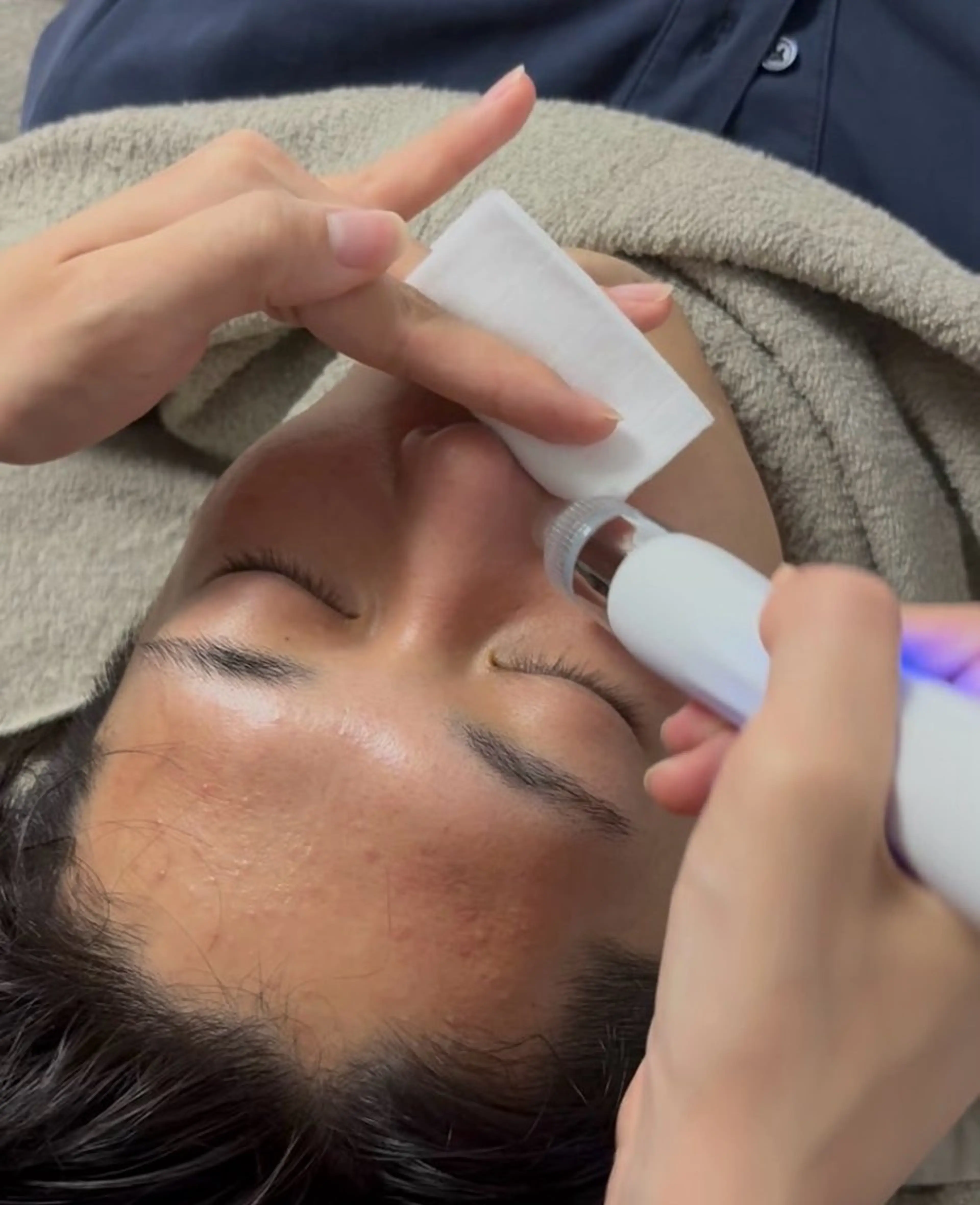 ◆毛穴洗浄 人気No.3◆SNS・各種メディアで話題沸騰中♪毛穴ケアx水光肌］の写真