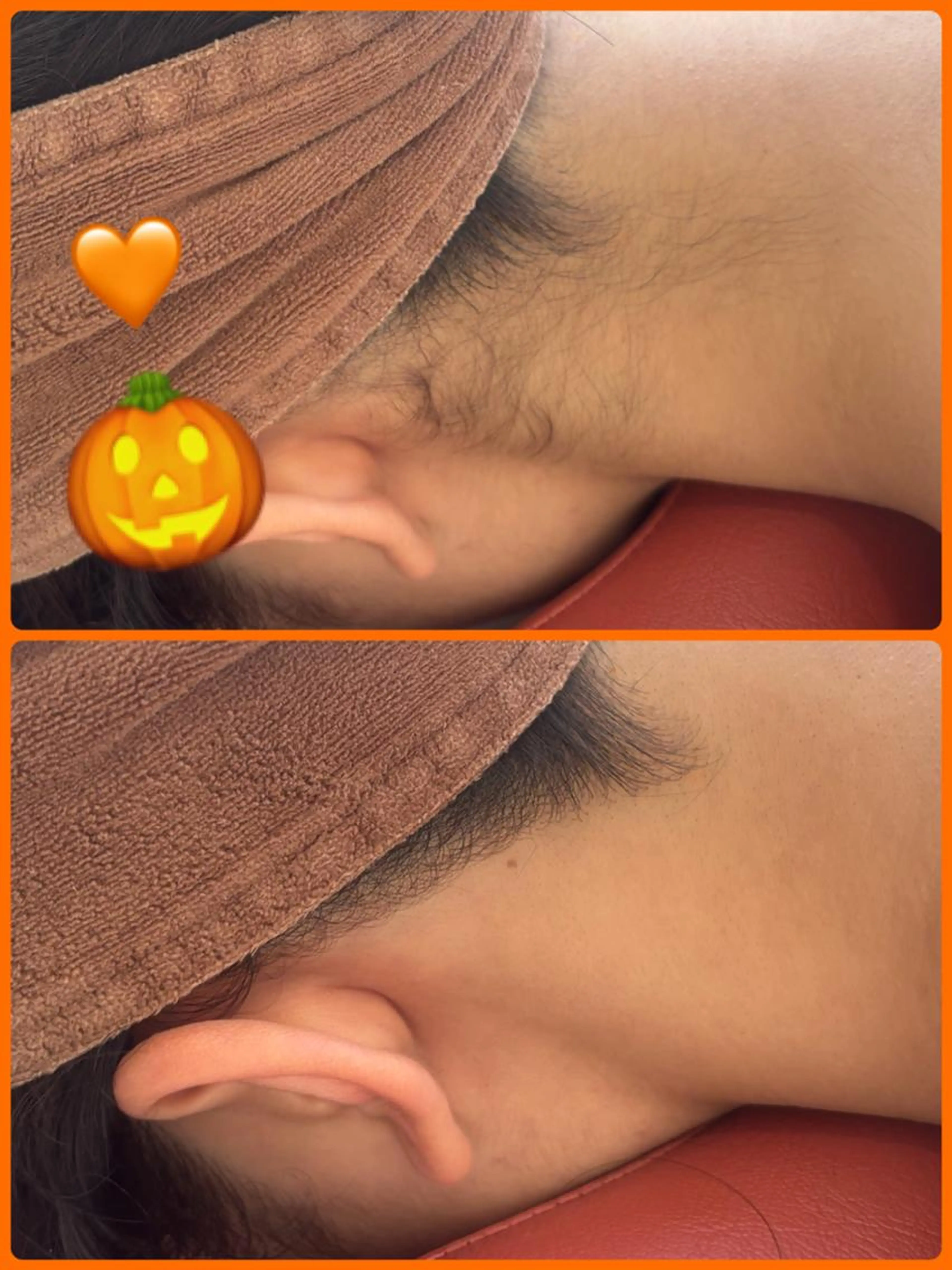 🍂秋こそ美しさを手に🍂うなじ脱毛、ポニーテールや背中美人へ！是非1度お任せ下さい✨の写真