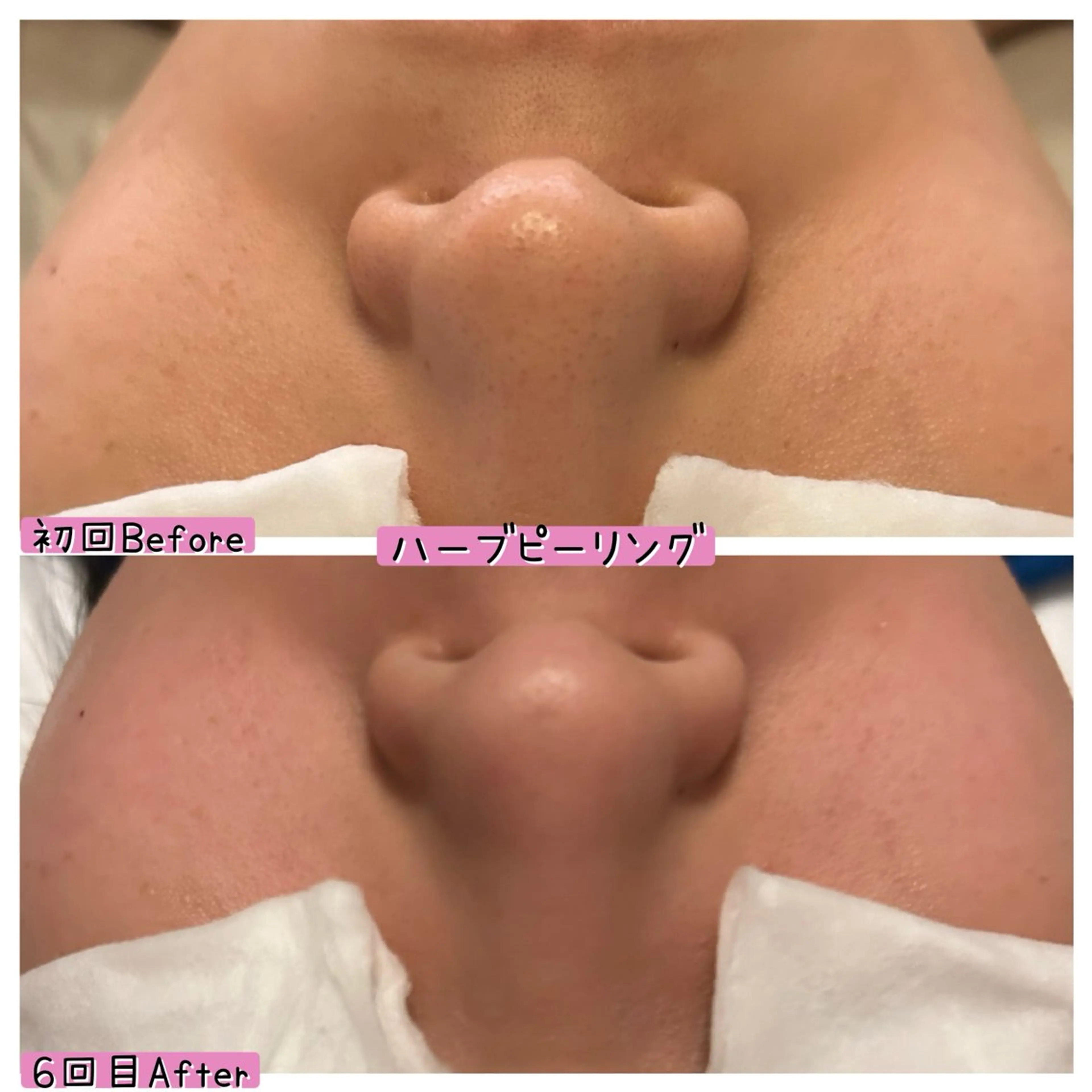 エステ ぱんだ王国エステ所属・ぱんだ王国 エステのエステ・リラクイメージ