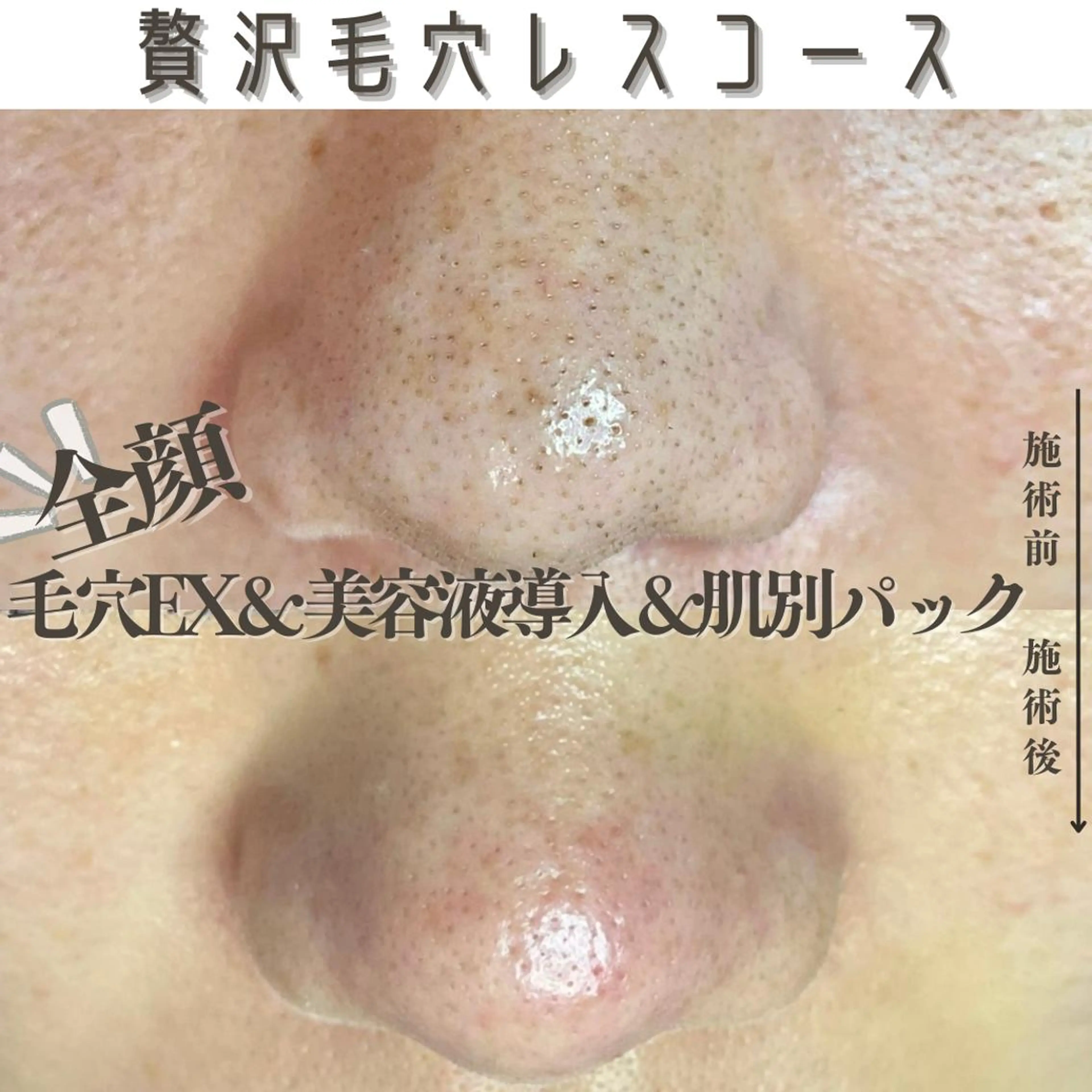 Muqu.所属・Muqu. 毛穴サロンのエステ・リラクイメージ