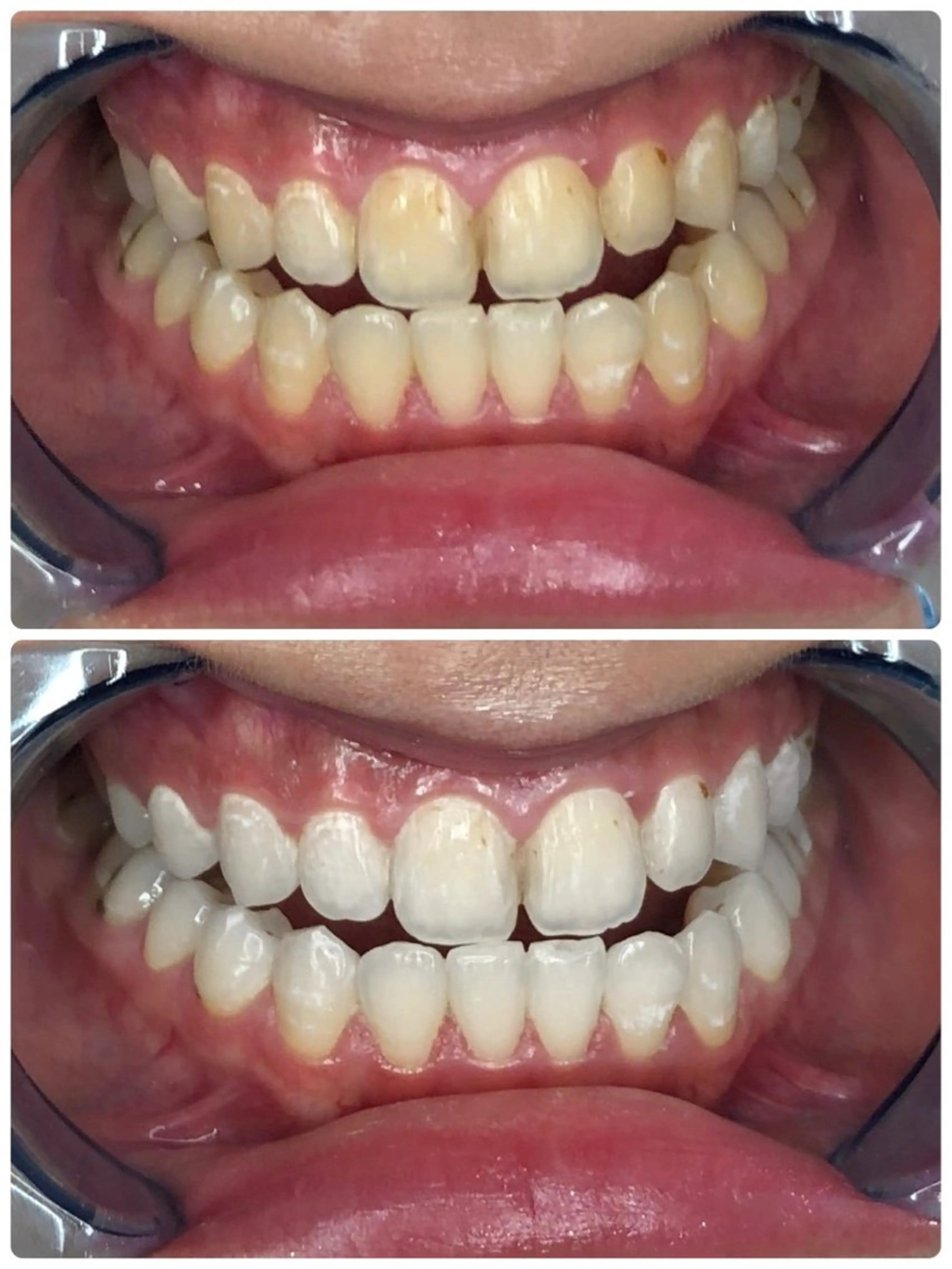 ホワイトニングサロンaile所属・セルフホワイトニング 金城しおりのその他イメージ