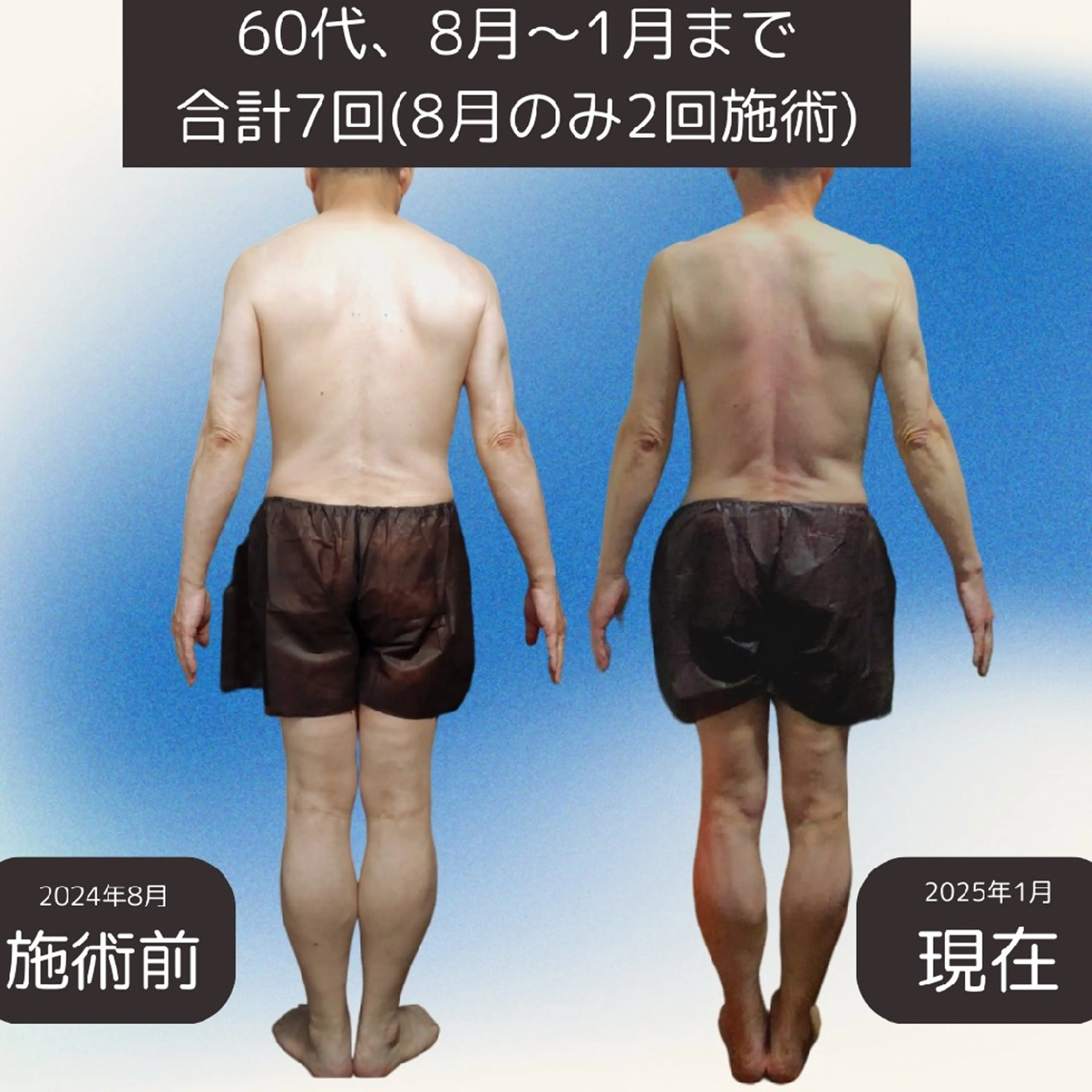 エステ リラク Ichi Fluorite Body所属・榊 由衣のエステ・リラクイメージ