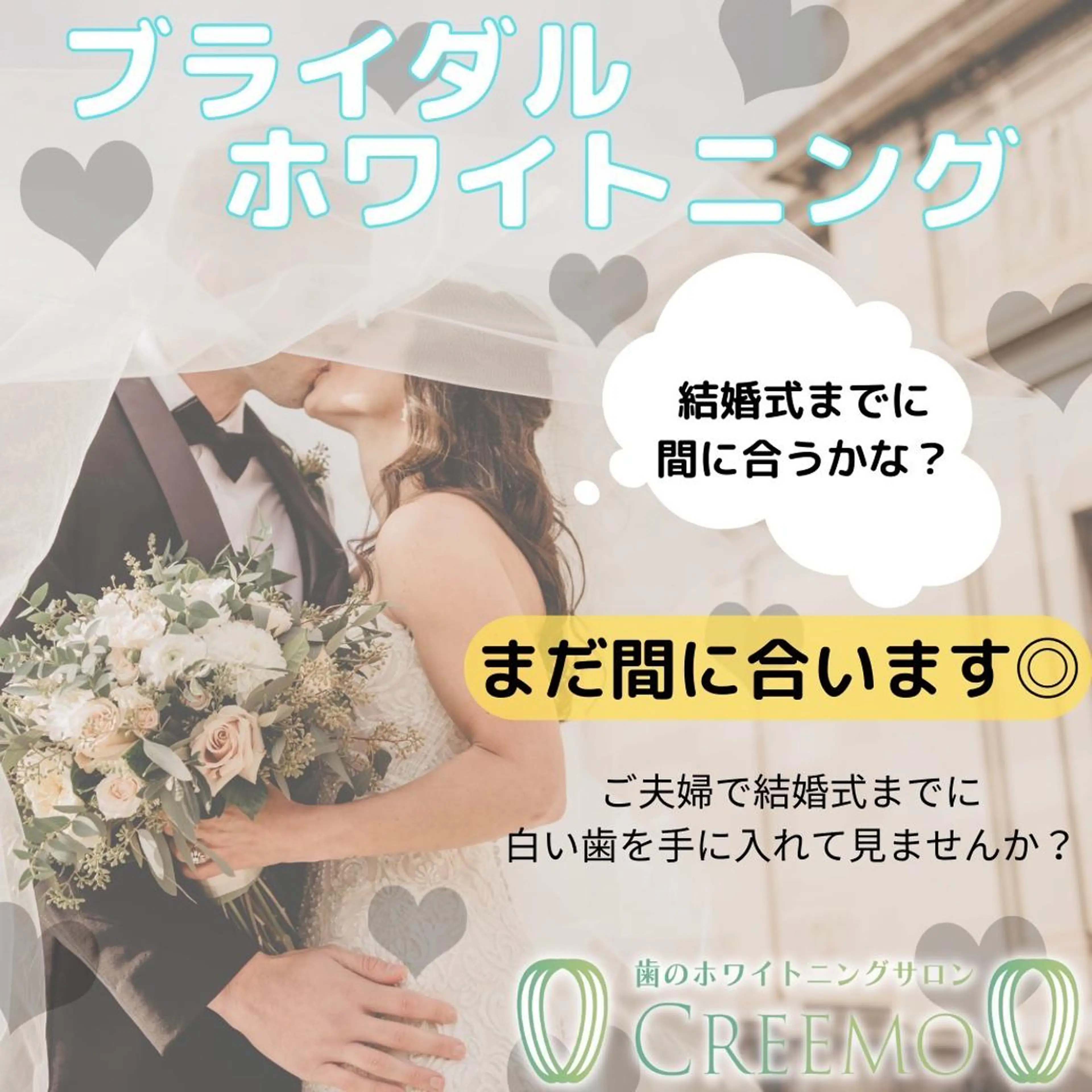その他 歯のホワイトニング CREEMO南浦和のその他イメージ