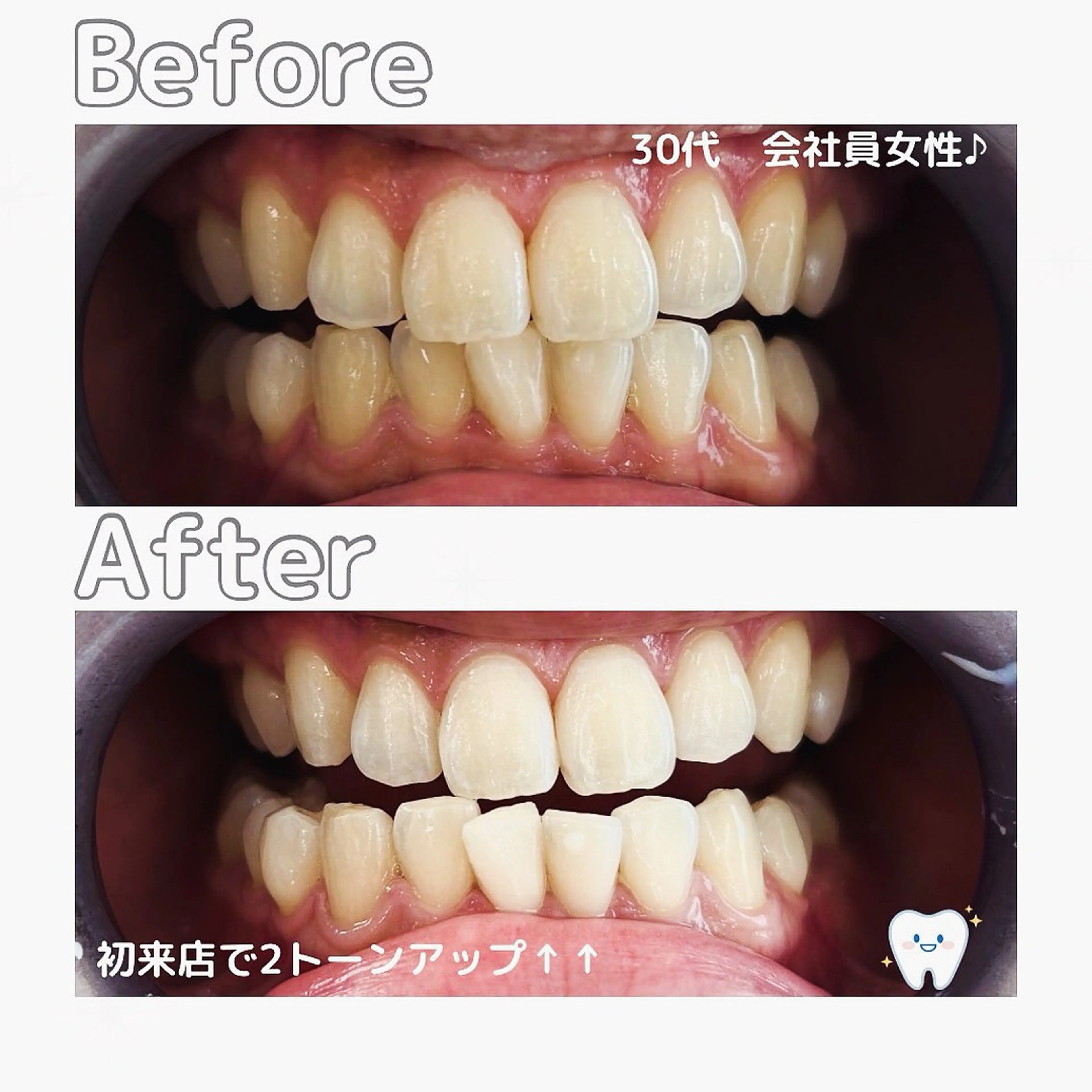 Whitening Beauty 市川妙典店所属・天根 春香のエステ・リラクイメージ