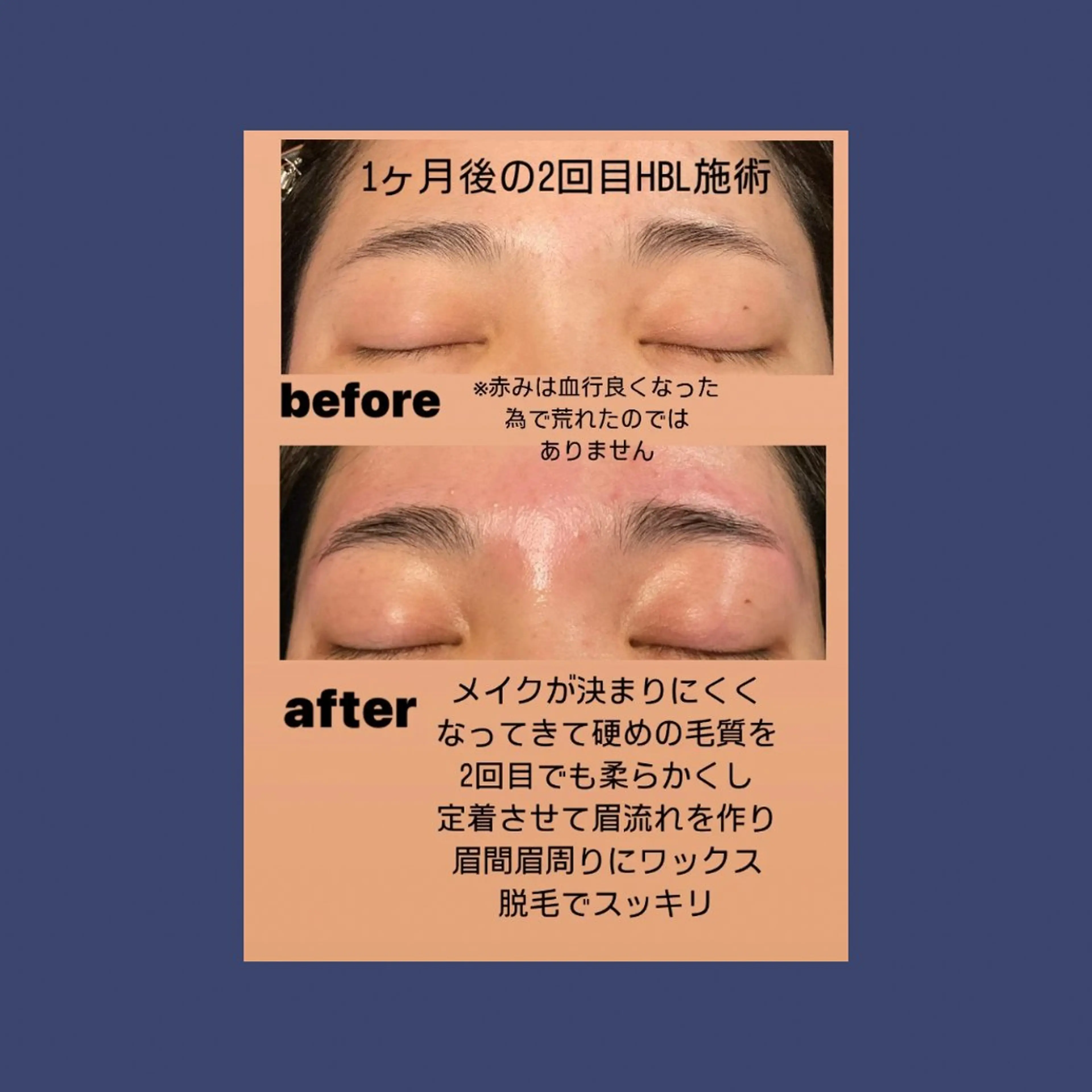 アイブロウ SALON DE TAMMYのエステ・リラクイメージ