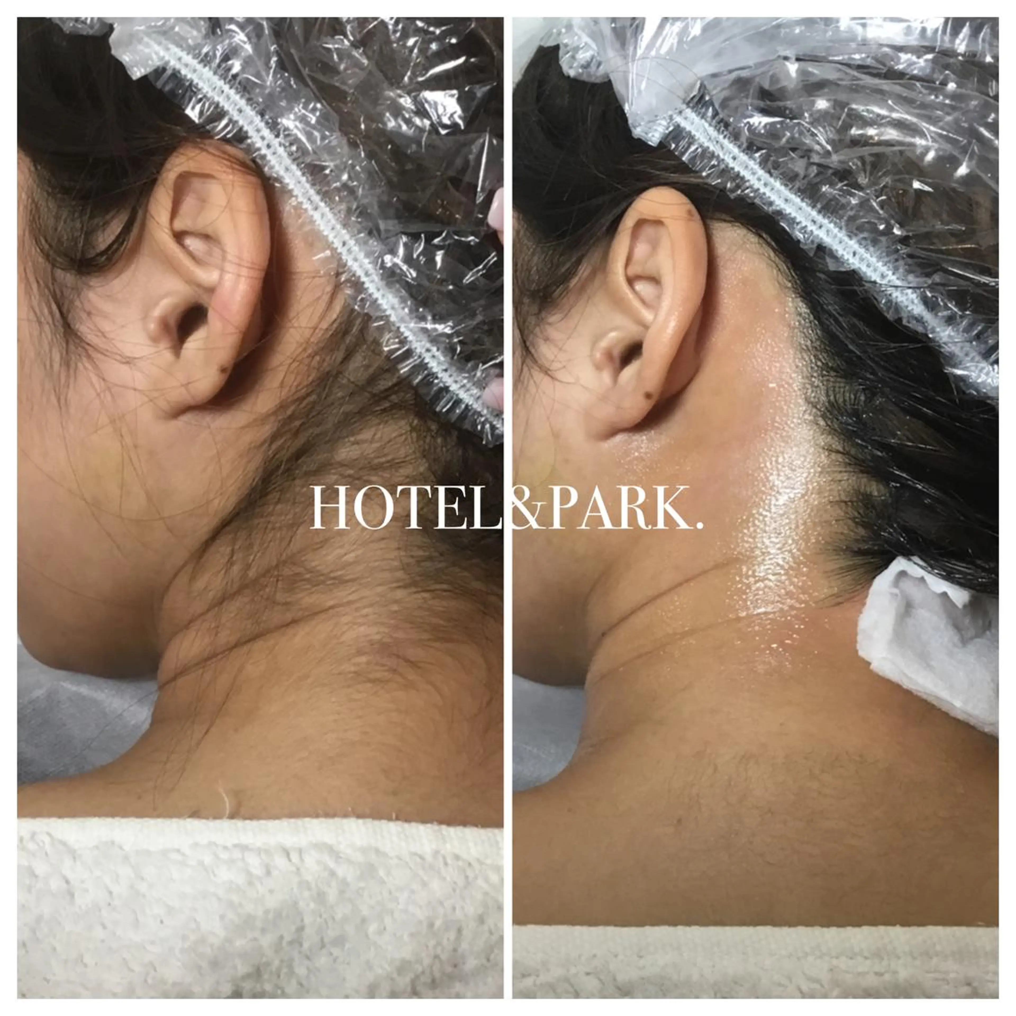 HOTEL&PARK . ワックス脱毛のエステ・リラクイメージ