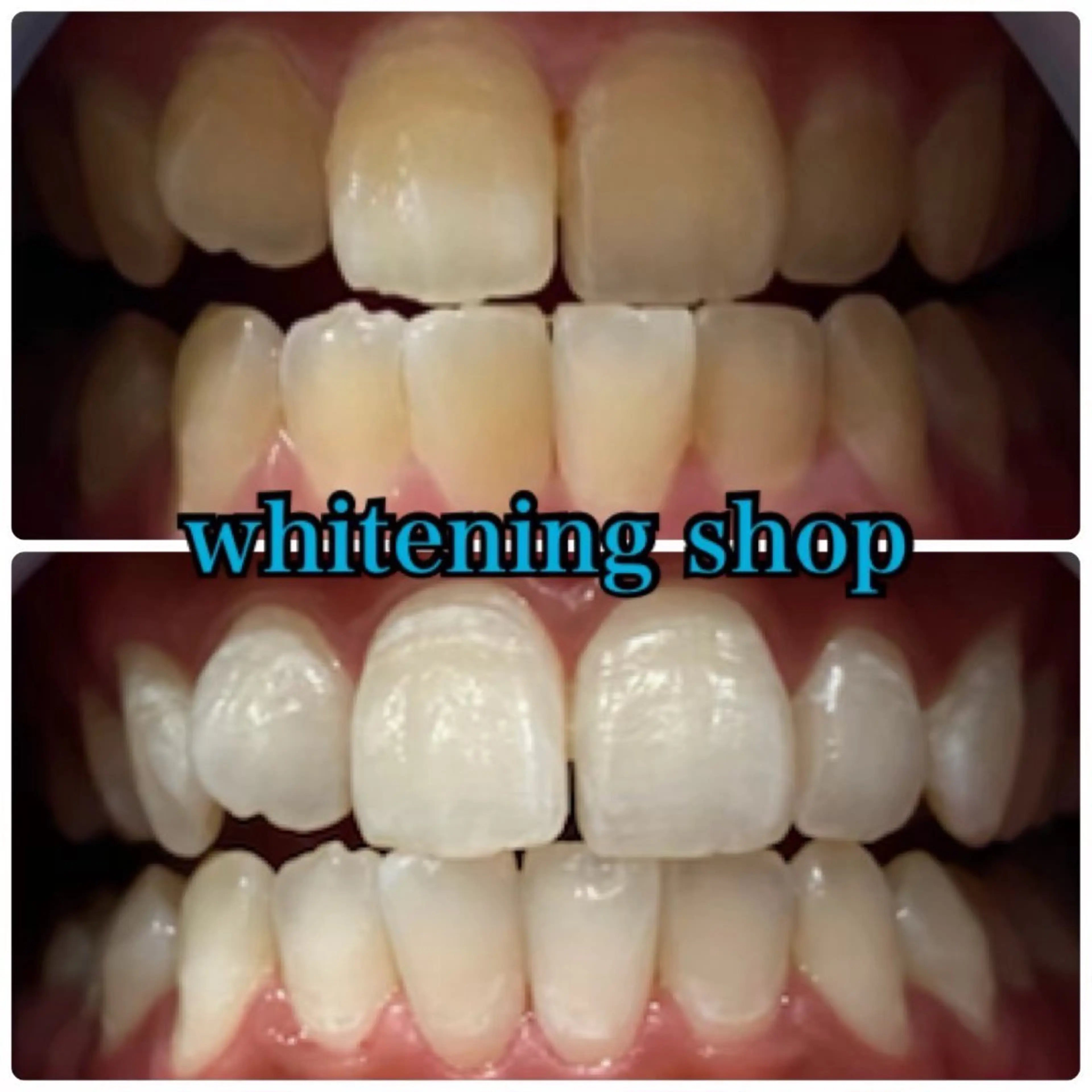 その他 ホワイトニングショップ静岡葵区店所属・ホワイトニング ショップ静岡葵区店のその他イメージ