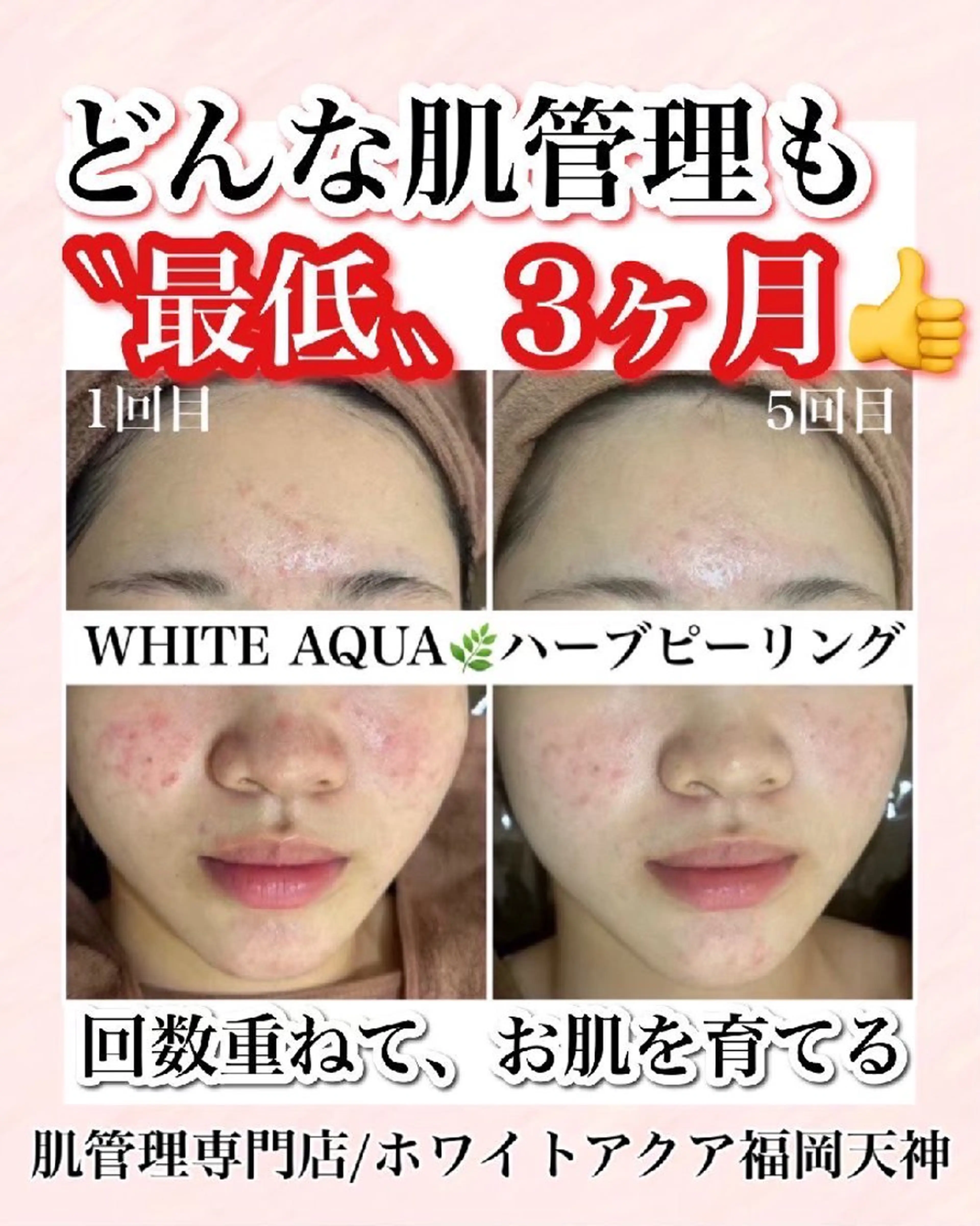 メンズ キッズ WHITEAQUA 福岡天神店のエステ・リラクイメージ