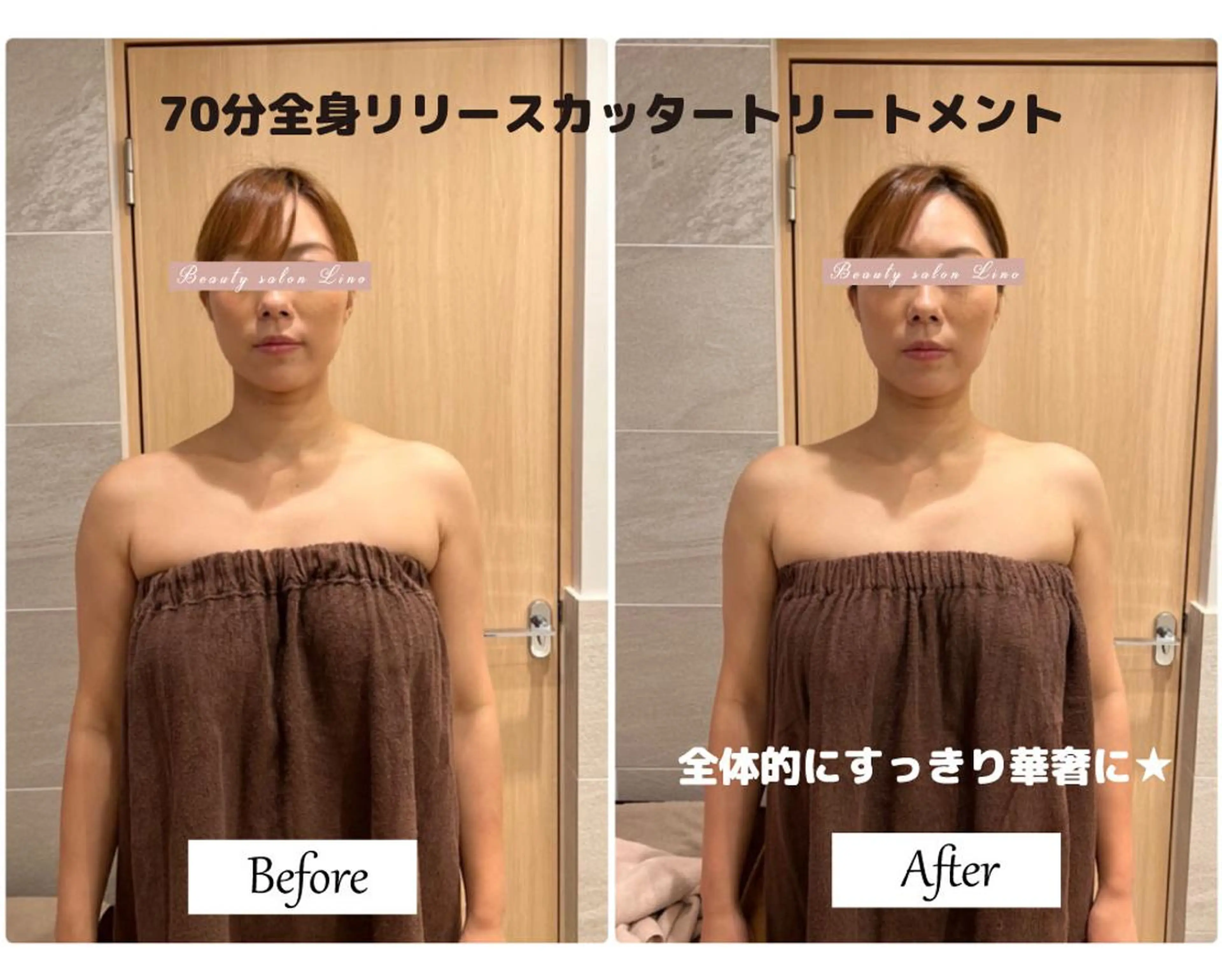 痩身×フェイシャル ブライダル|Linoのエステ・リラクイメージ