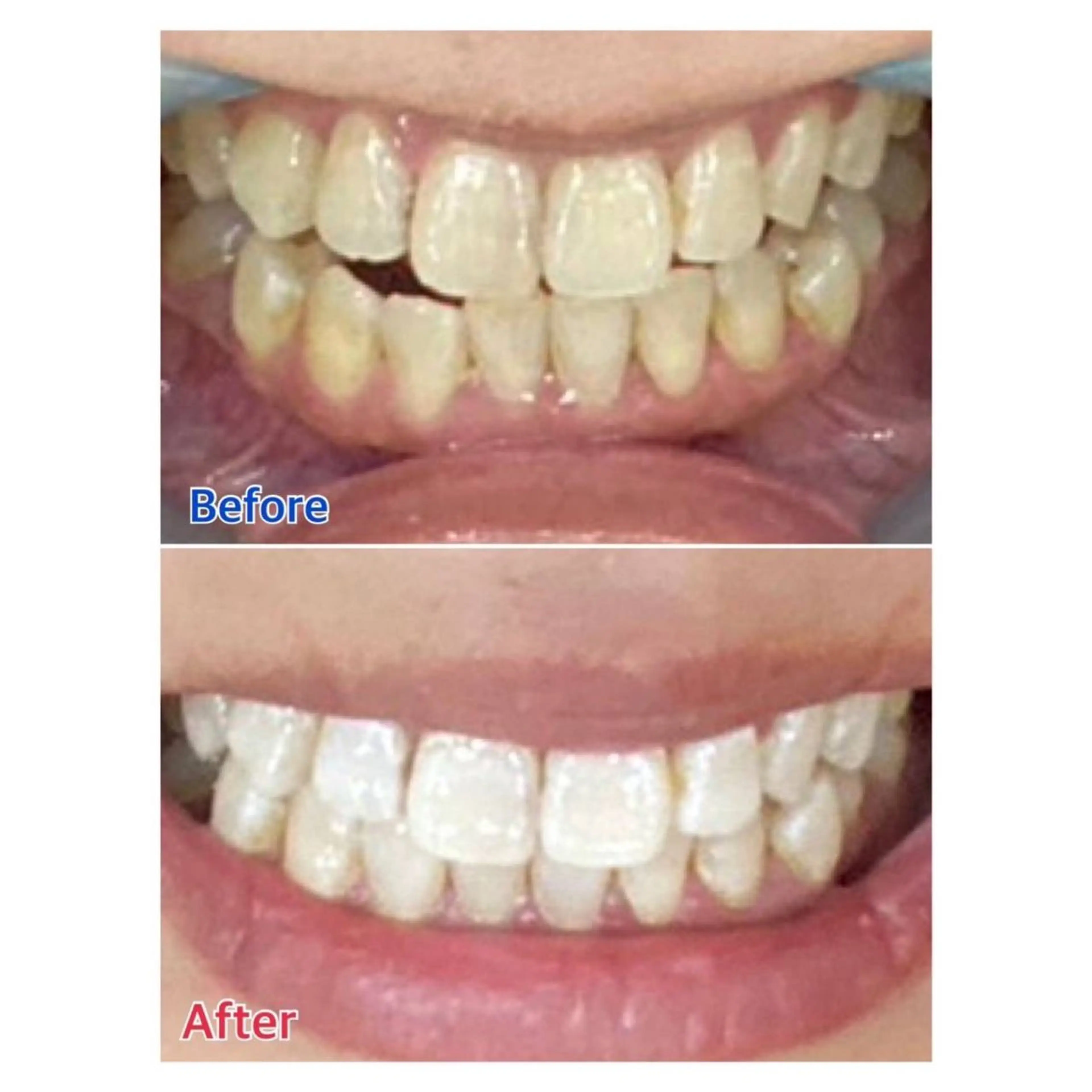 MBEAUTYSALON 千葉店・京成大久保所属・Melty 輝のその他イメージ