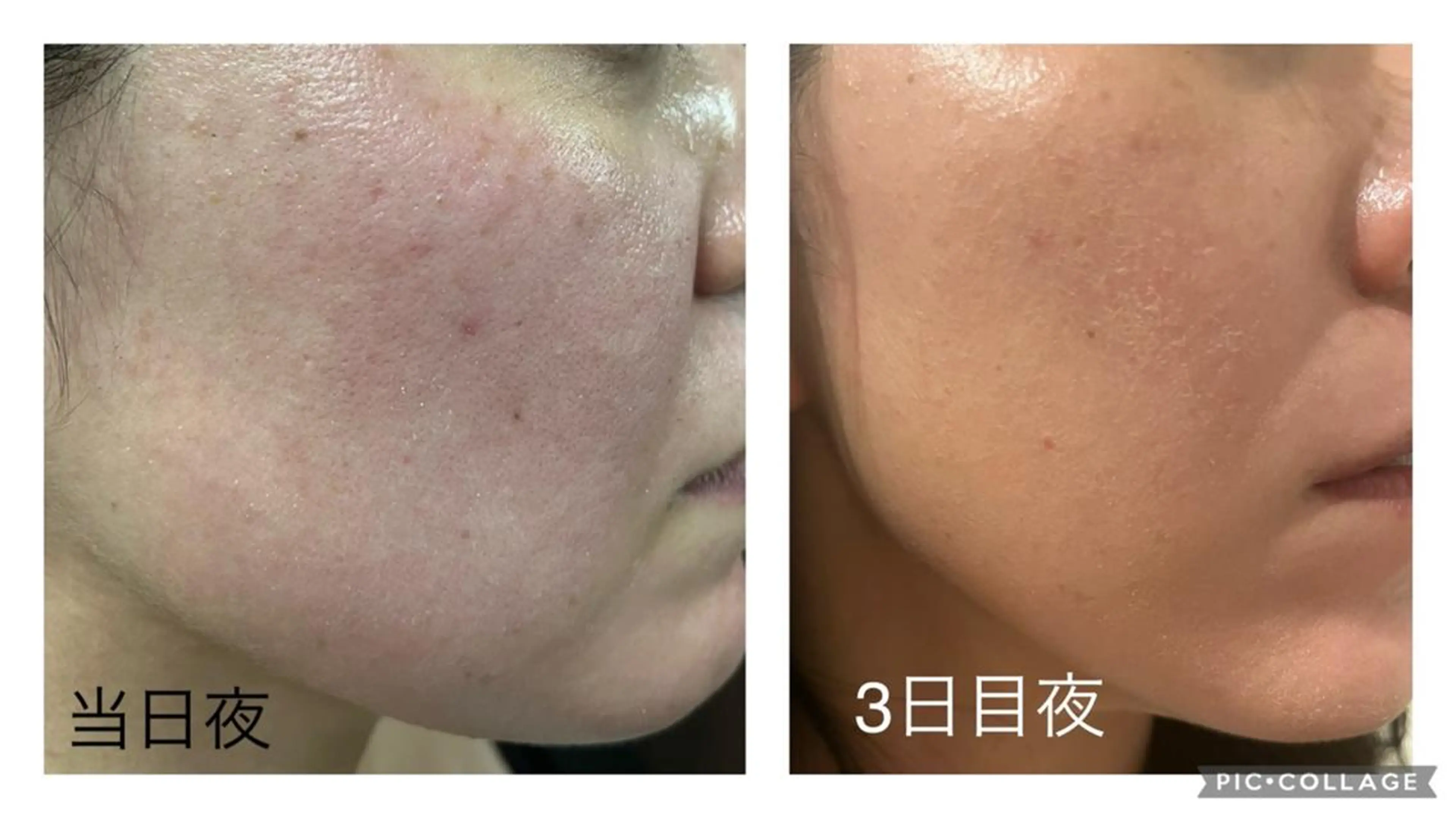 エステ 👑Linolaby RAYVIS👑⭐️のエステ・リラクイメージ