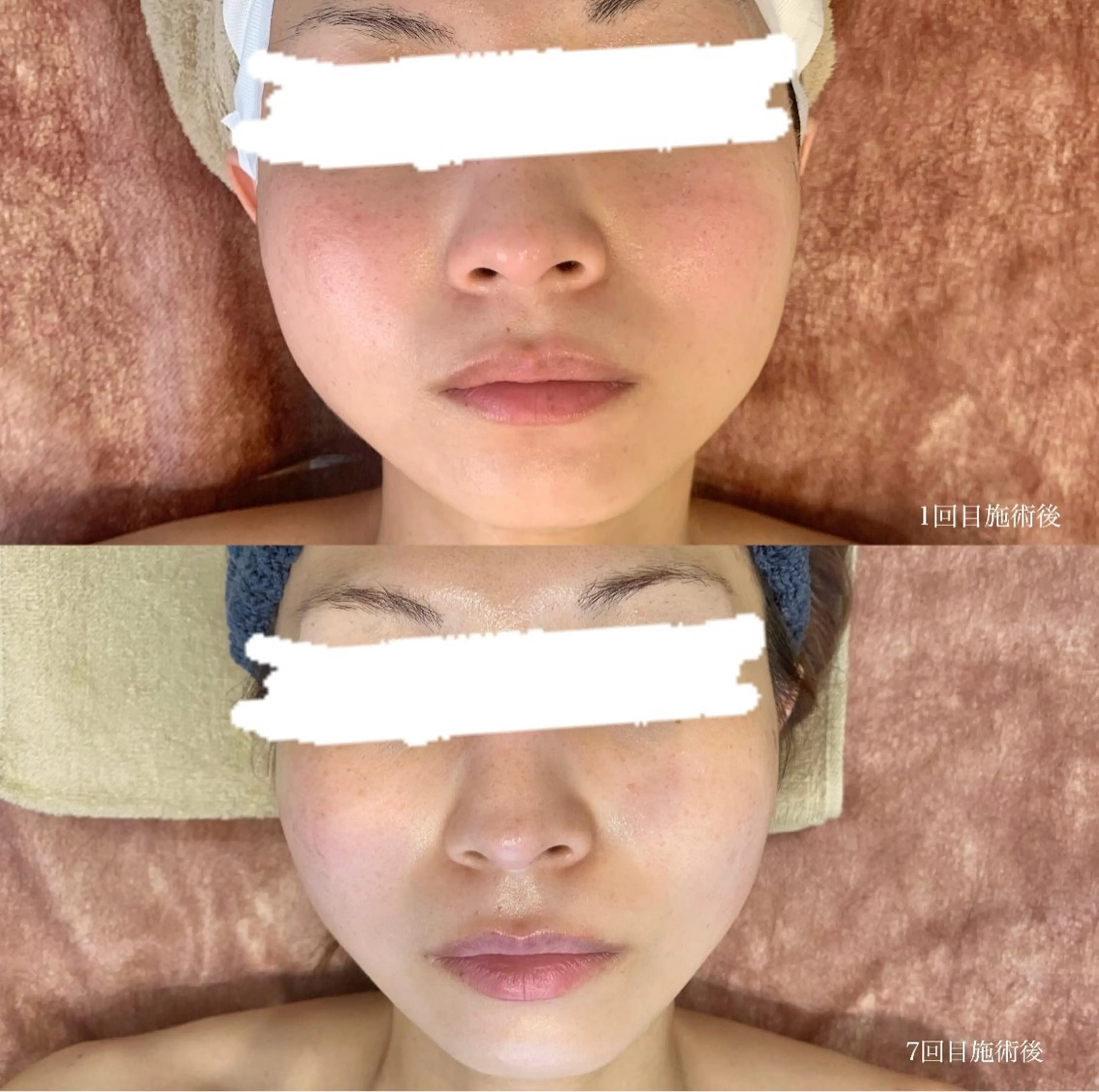 エステ beauty salon Belle所属・Belle【ベル】 YUKA⸜🌷︎⸝‍のエステ・リラクイメージ