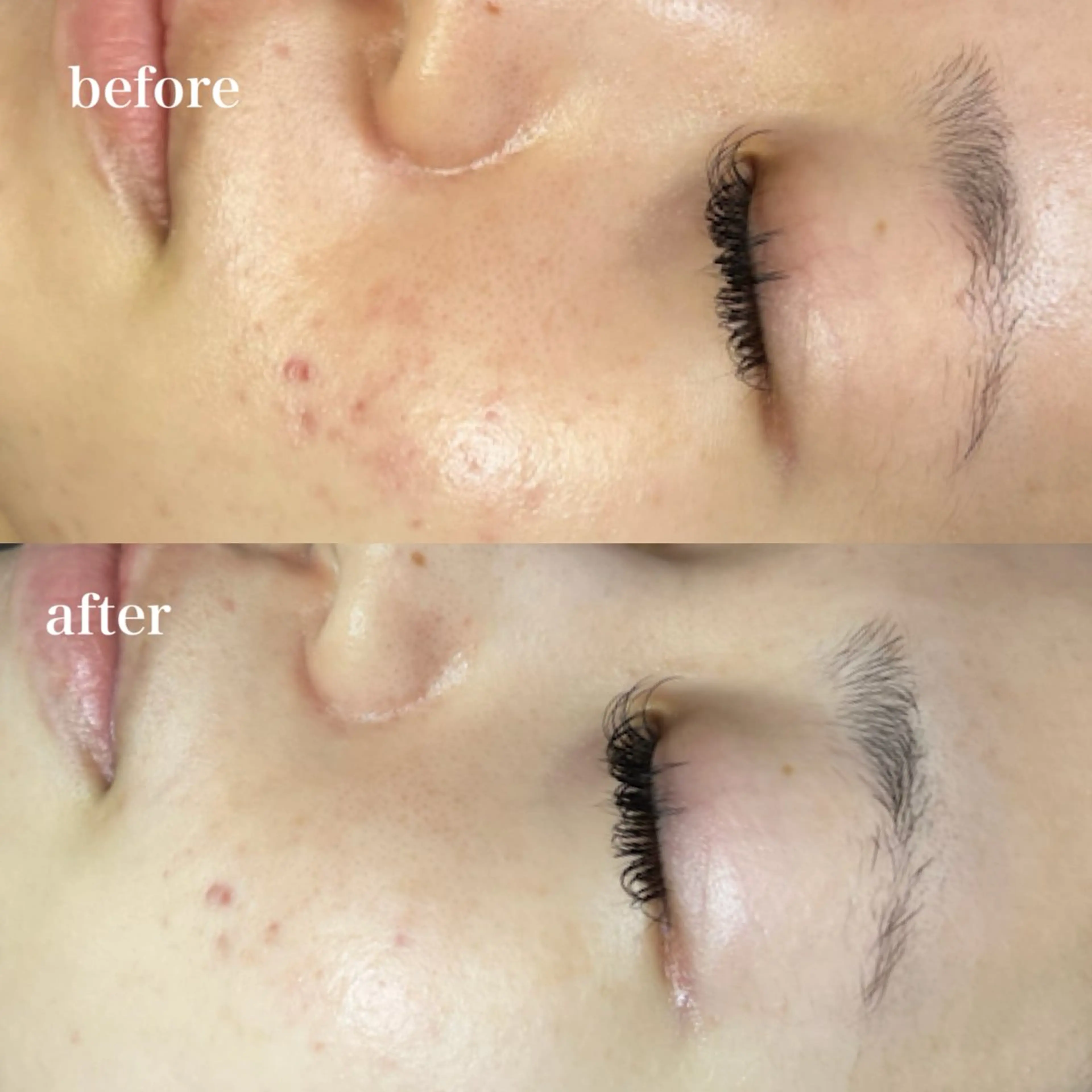 エステ hitomi ヒトミのエステ・リラクイメージ