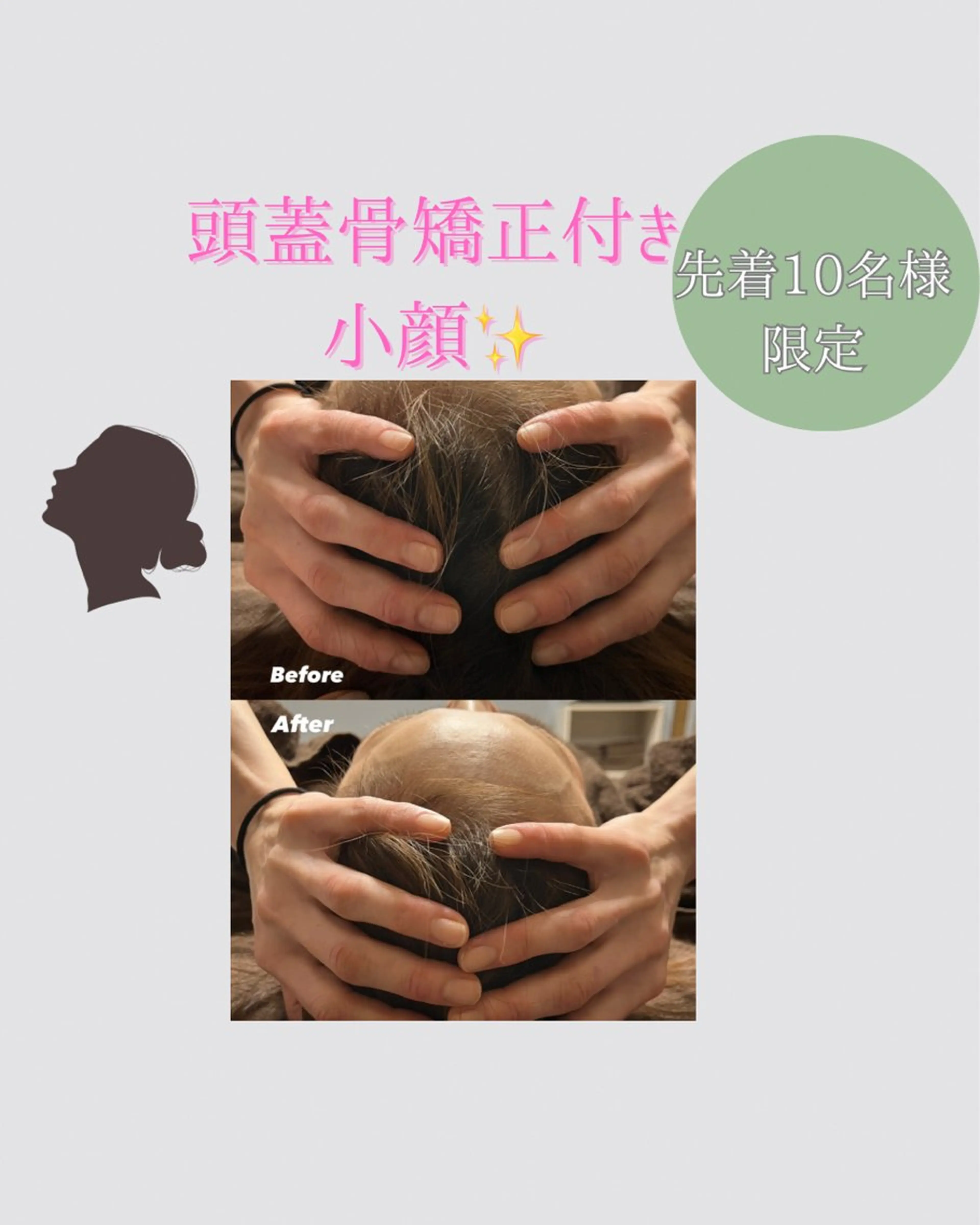 先着順【10名様限定】3step小顔＋頭蓋骨矯正付き（100min）¥22,000→¥4,950の写真