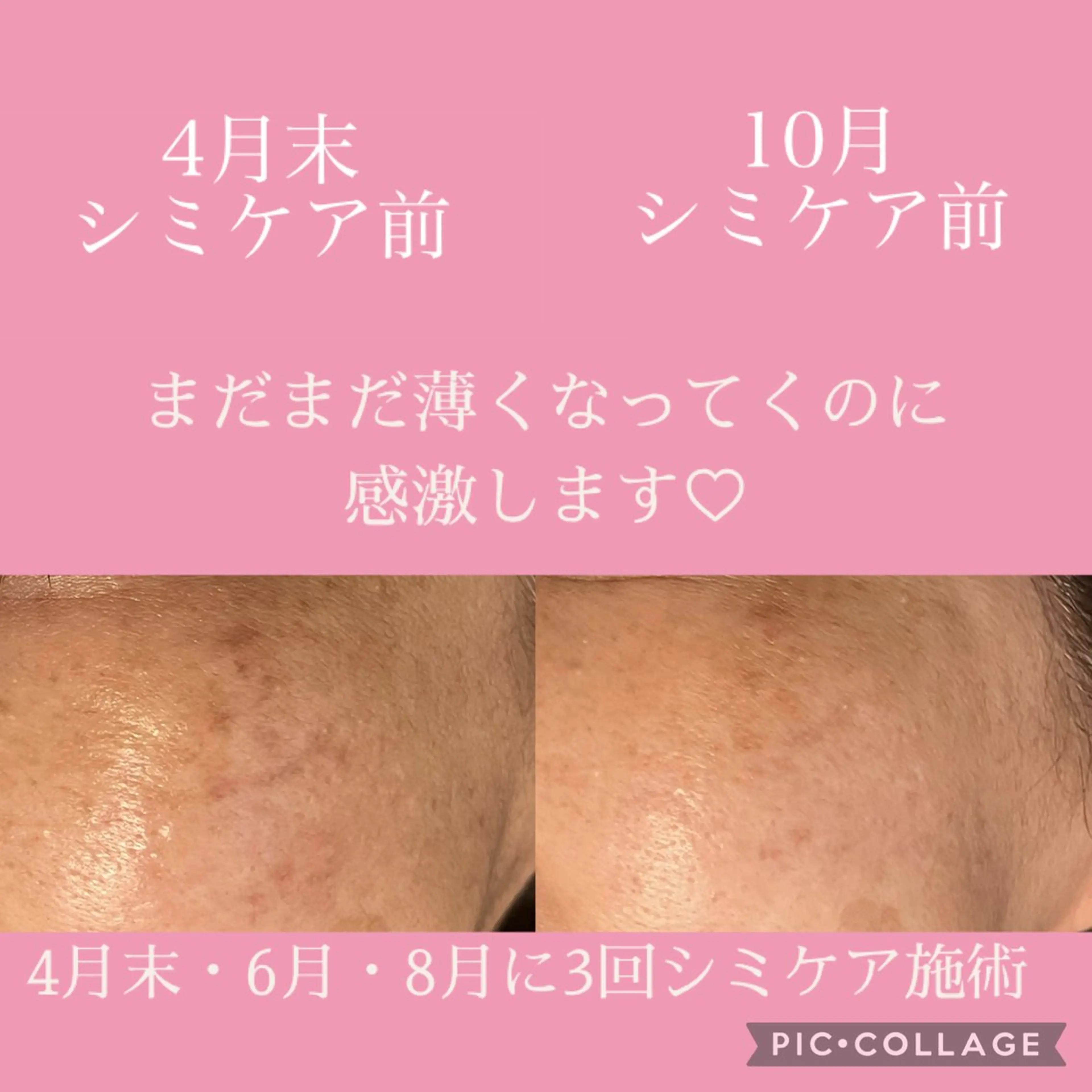 エステ Asana所属・asana 2021のエステ・リラクイメージ