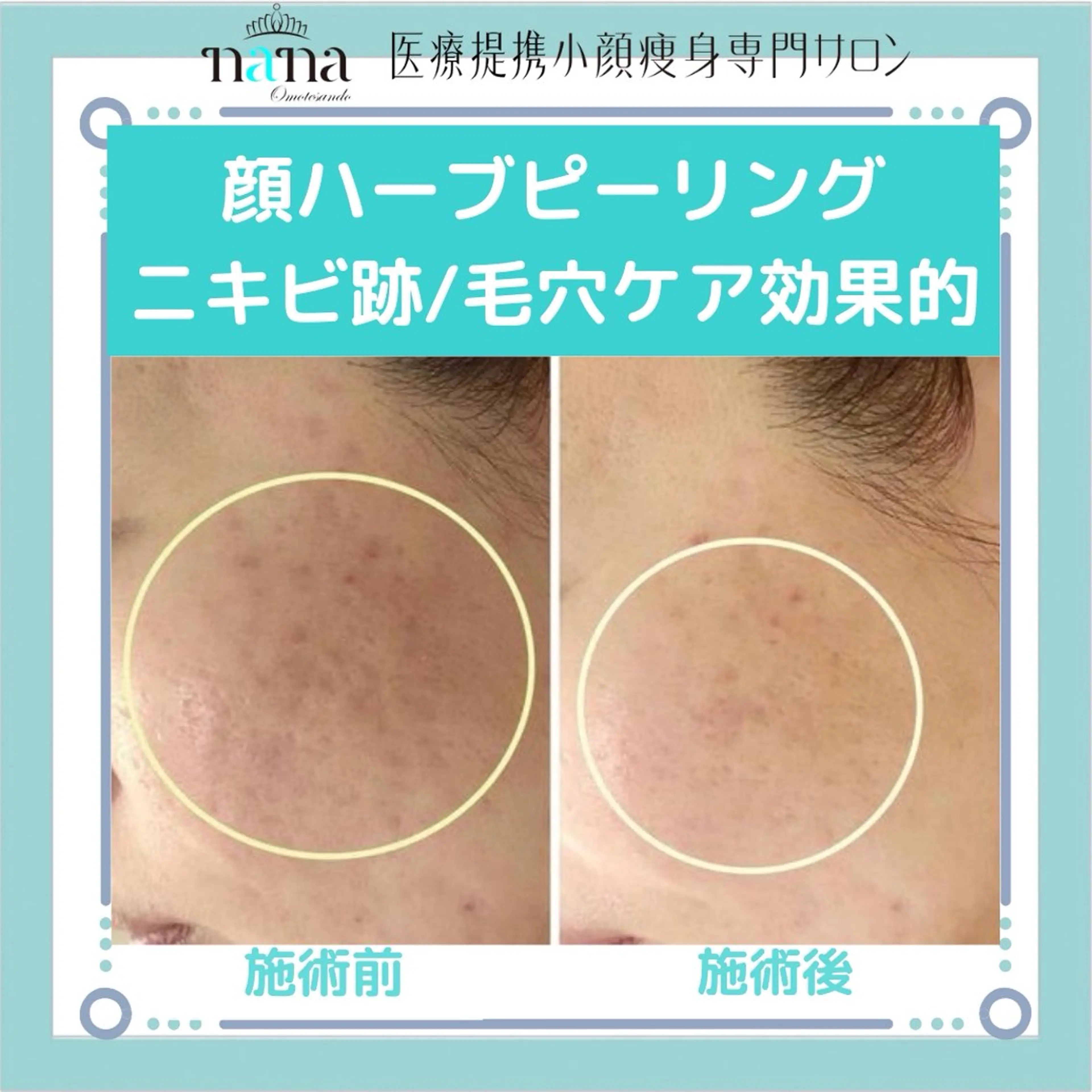 小顔痩身インディバ Nana表参道のエステ・リラクイメージ