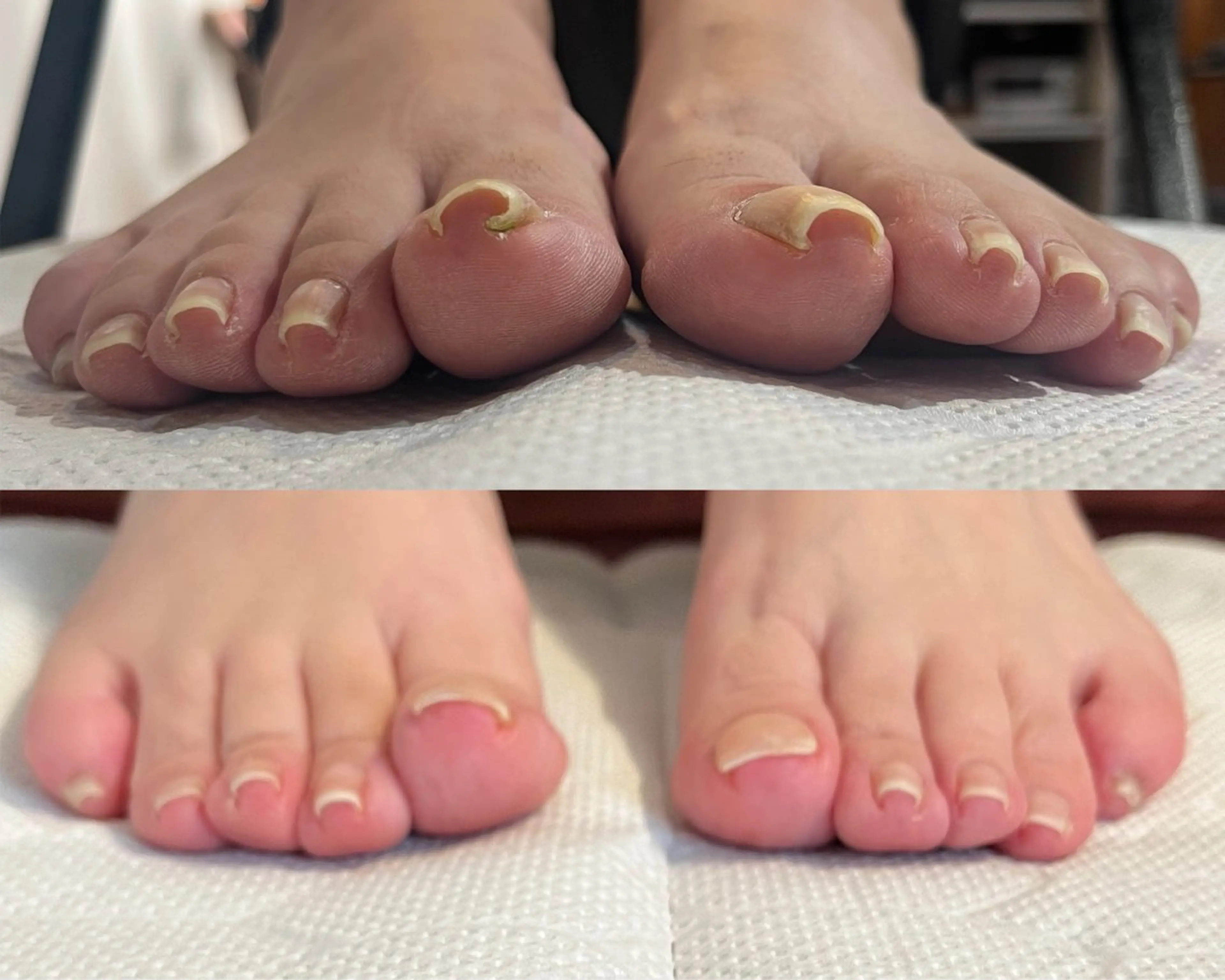 足のトラブル巻き爪補正専門店るみえーる所属・EYELASH SARONるみえーるのマツエク・マツパデザイン