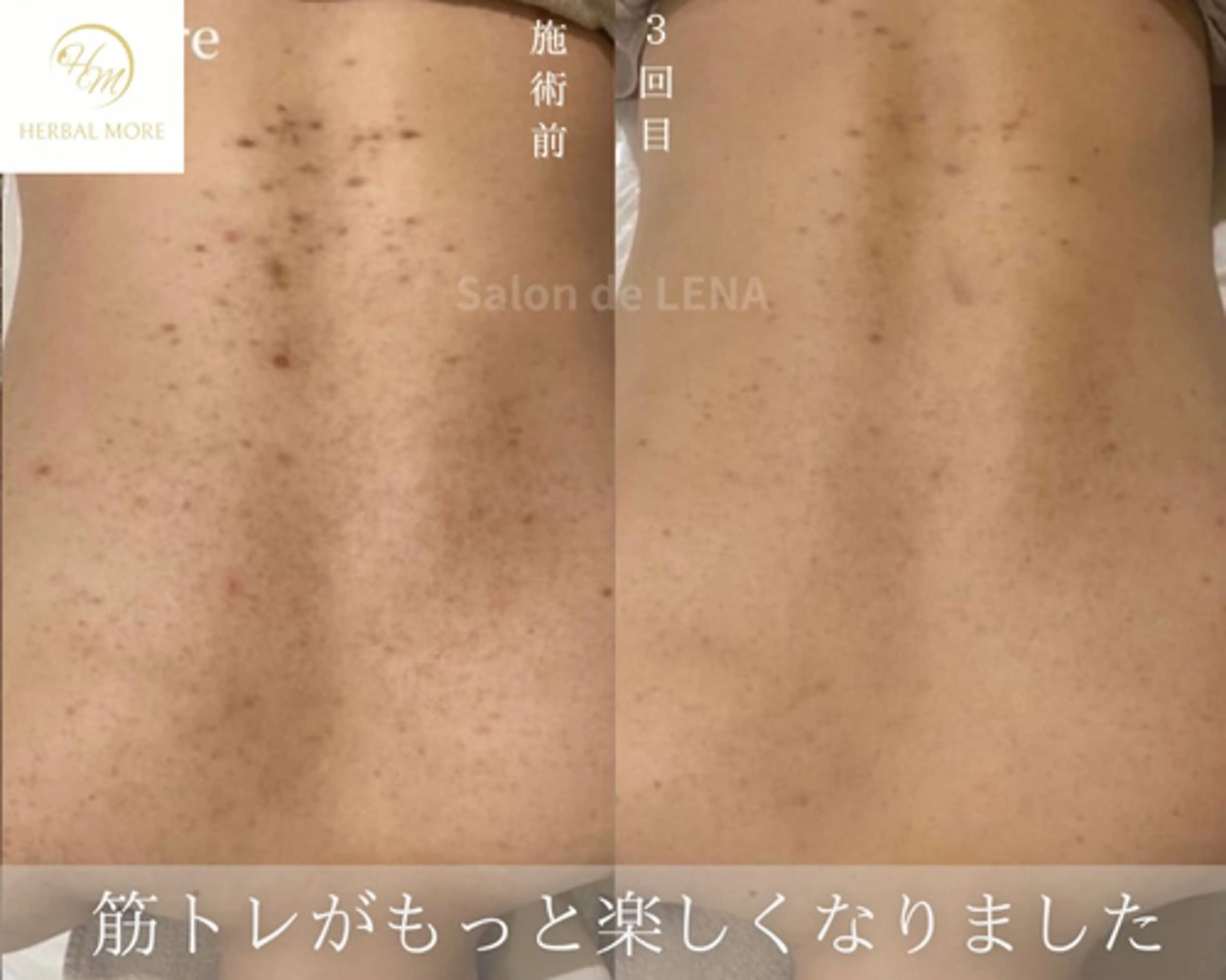 ハーブピーリング・毛穴ケア専門サロンSalon de LENA 栄店所属・ハーブピーリング専門 サロンドレナ　白藤のエステ・リラクイメージ