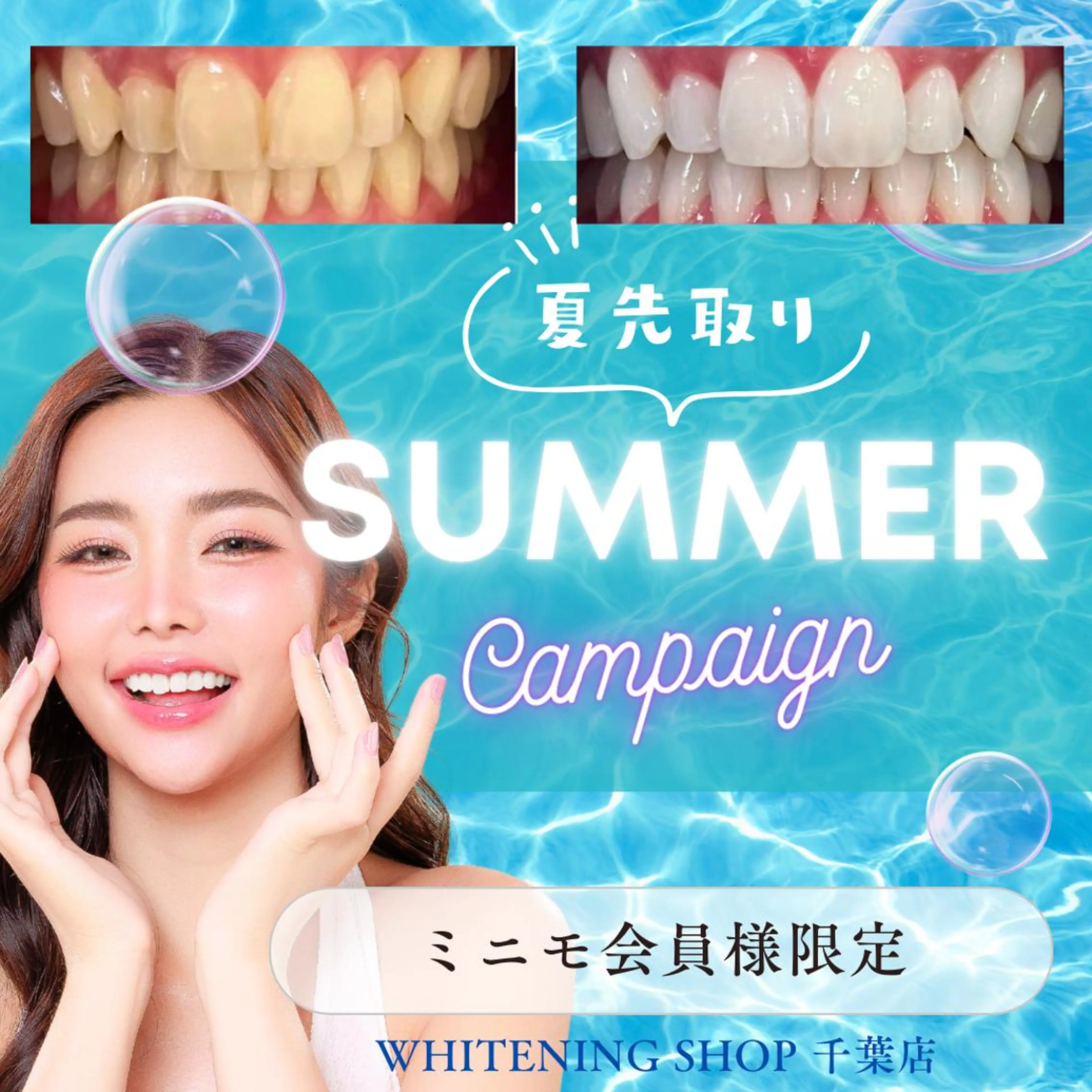 メンズ その他 ホワイトニング ショップ千葉店のその他イメージ