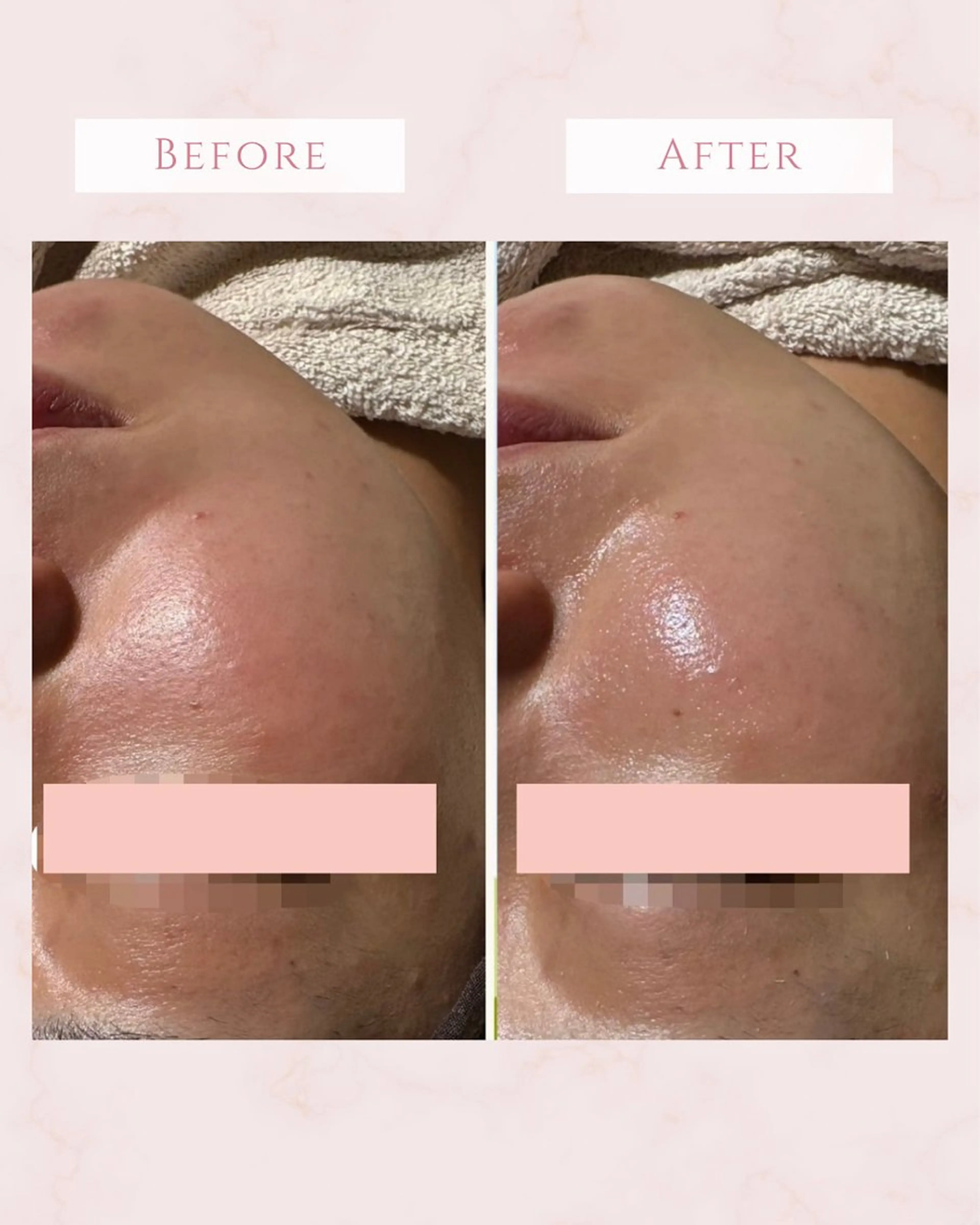 エステ Ricerca ビューティーサロンのエステ・リラクイメージ