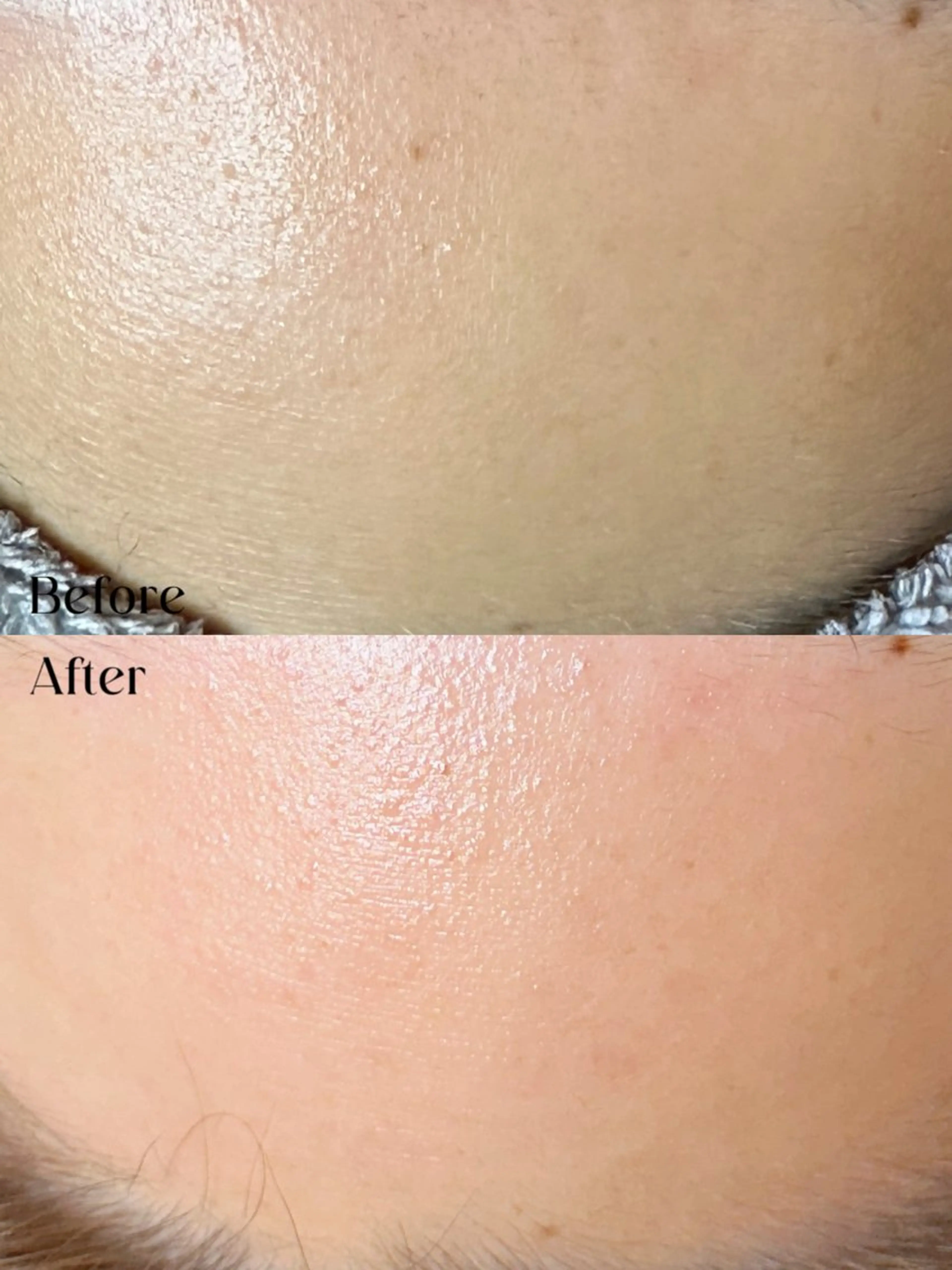 Hit. シュガーリング豊橋のエステ・リラクイメージ