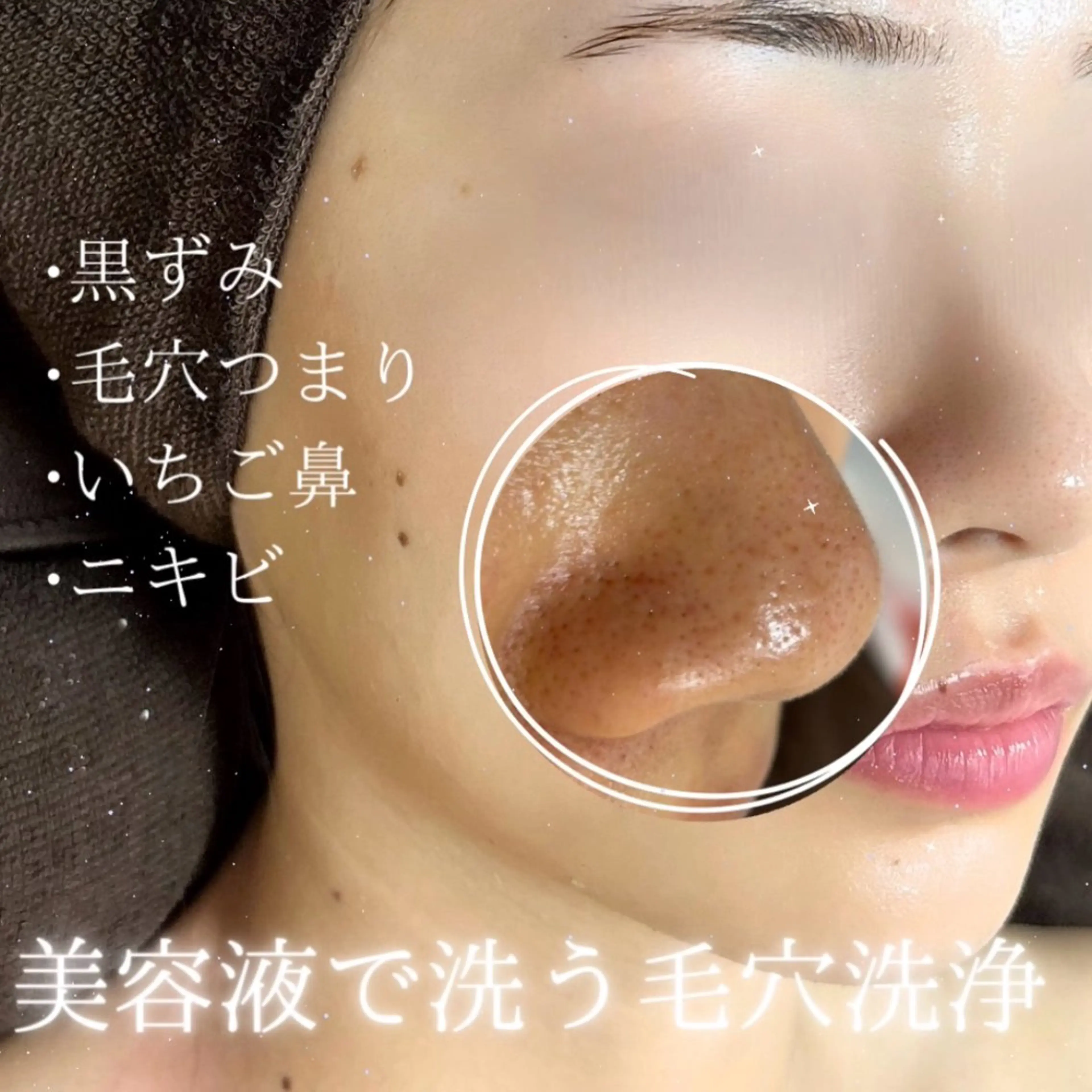 脱毛 lulularico Yu🫧のエステ・リラクイメージ