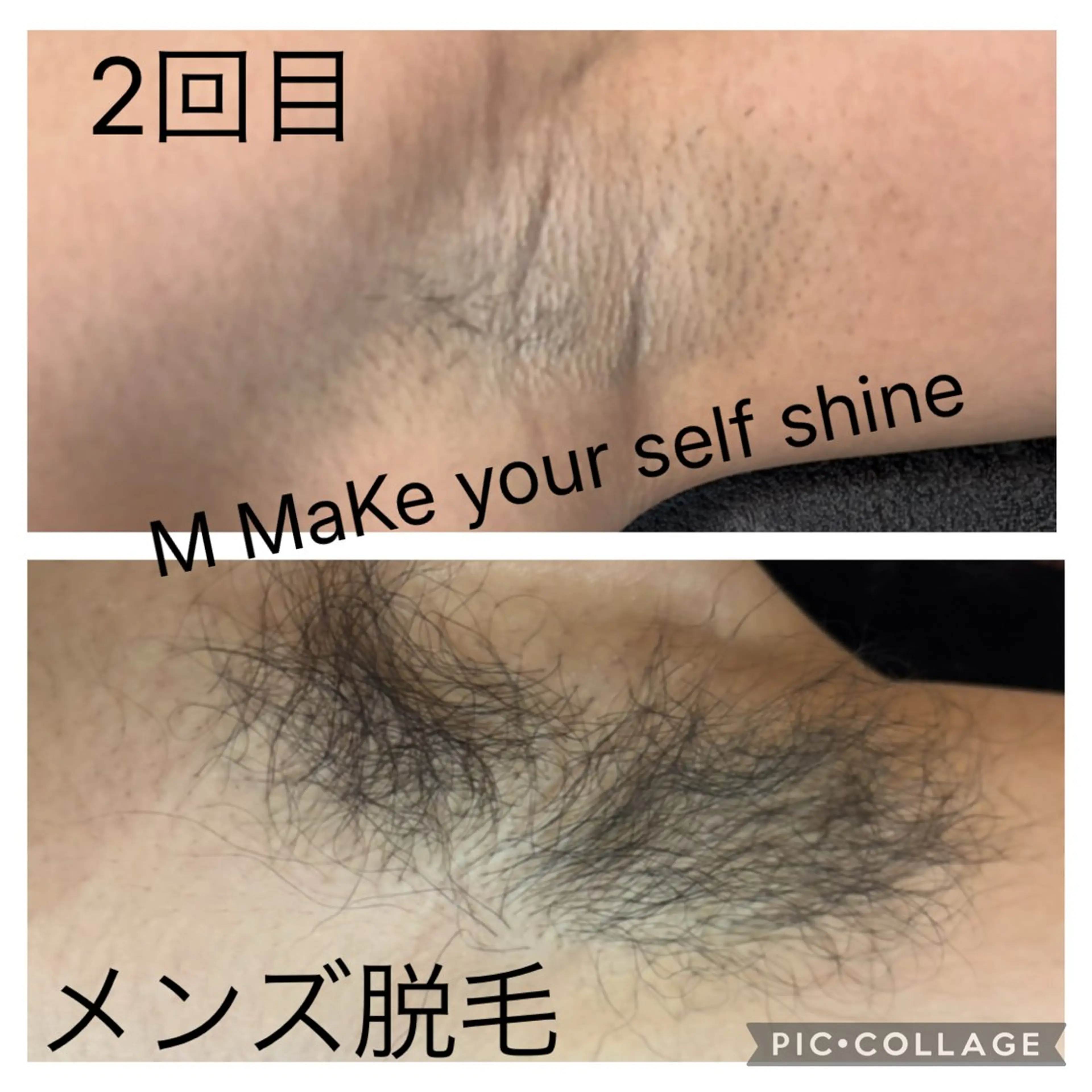 脱毛 M MaKe yourself shine所属・プライベート脱毛 Jr久宝寺のエステ・リラクイメージ