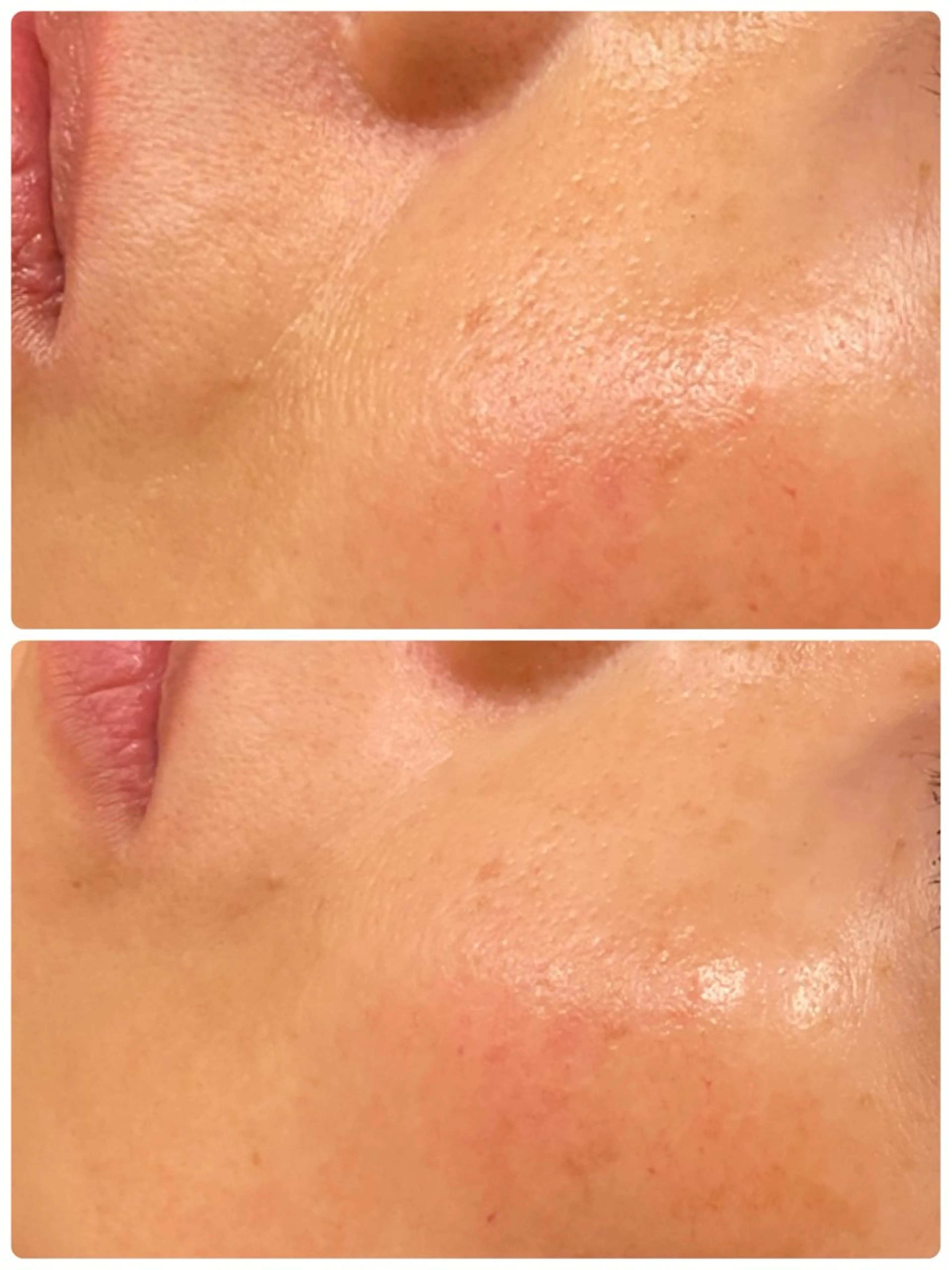 ビューティーラウンジ A&A✨佐藤✨のエステ・リラクイメージ