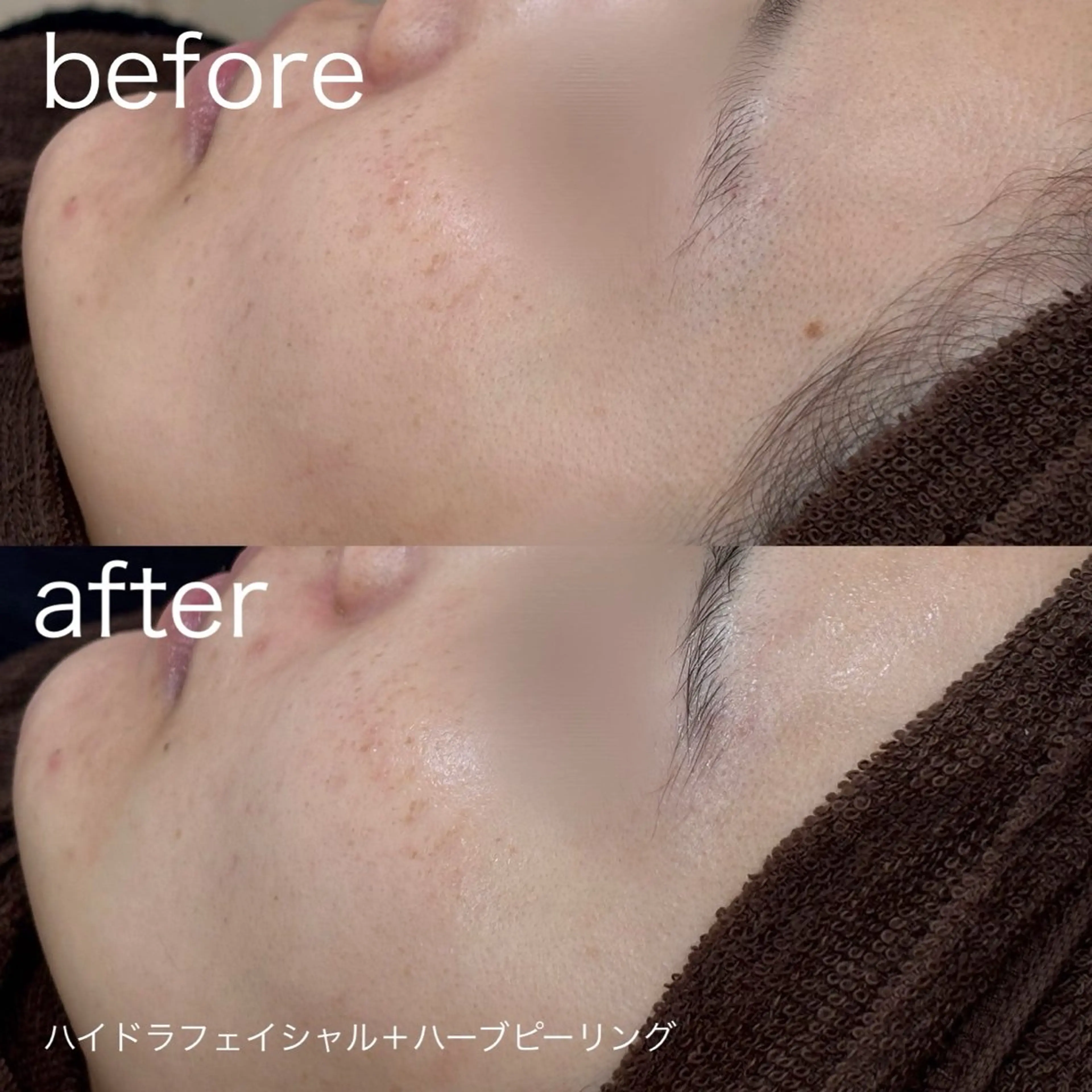 その他 lulularico Yu🫧のエステ・リラクイメージ