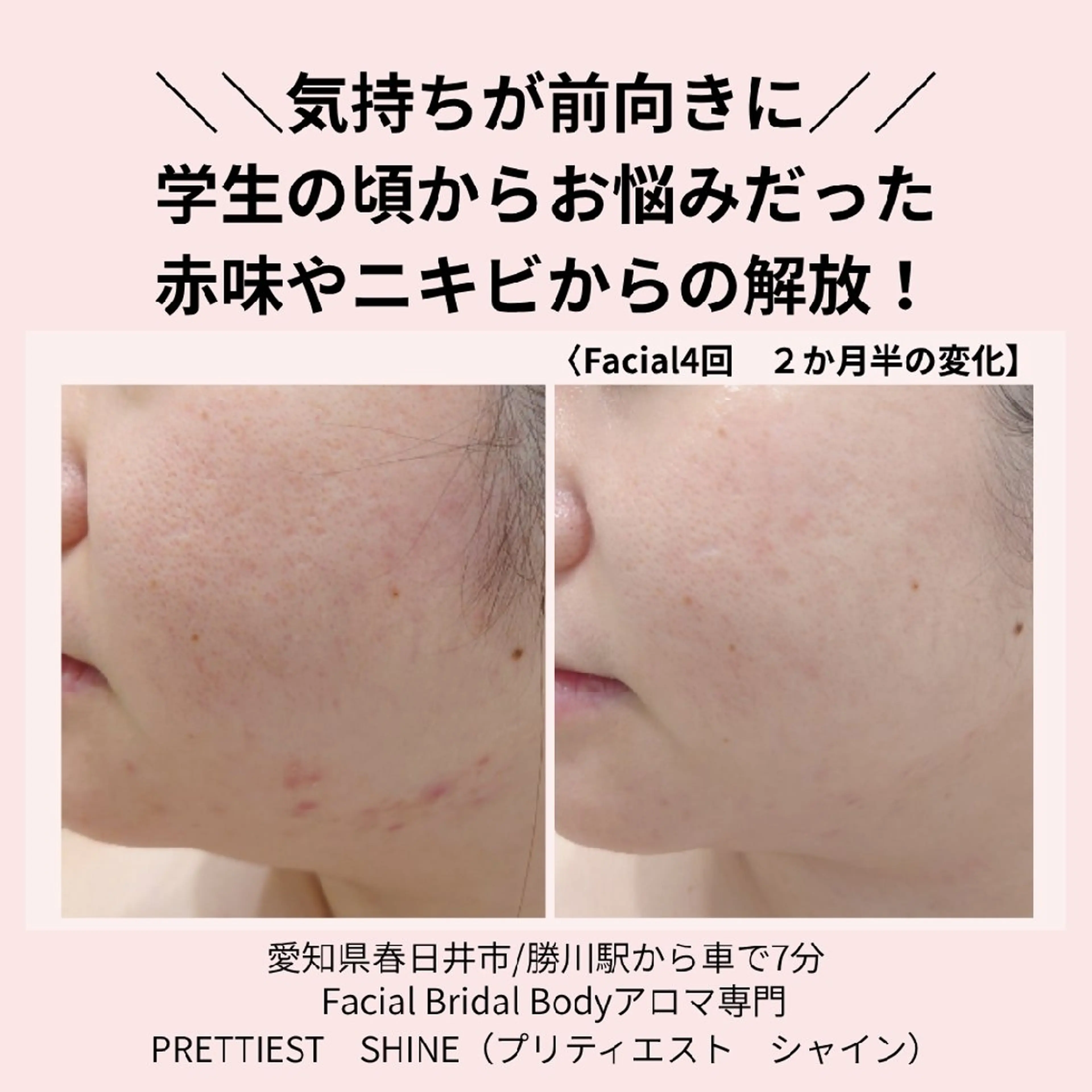 エステ PRETTIEST SHINE所属・山田 浩子のエステ・リラクイメージ