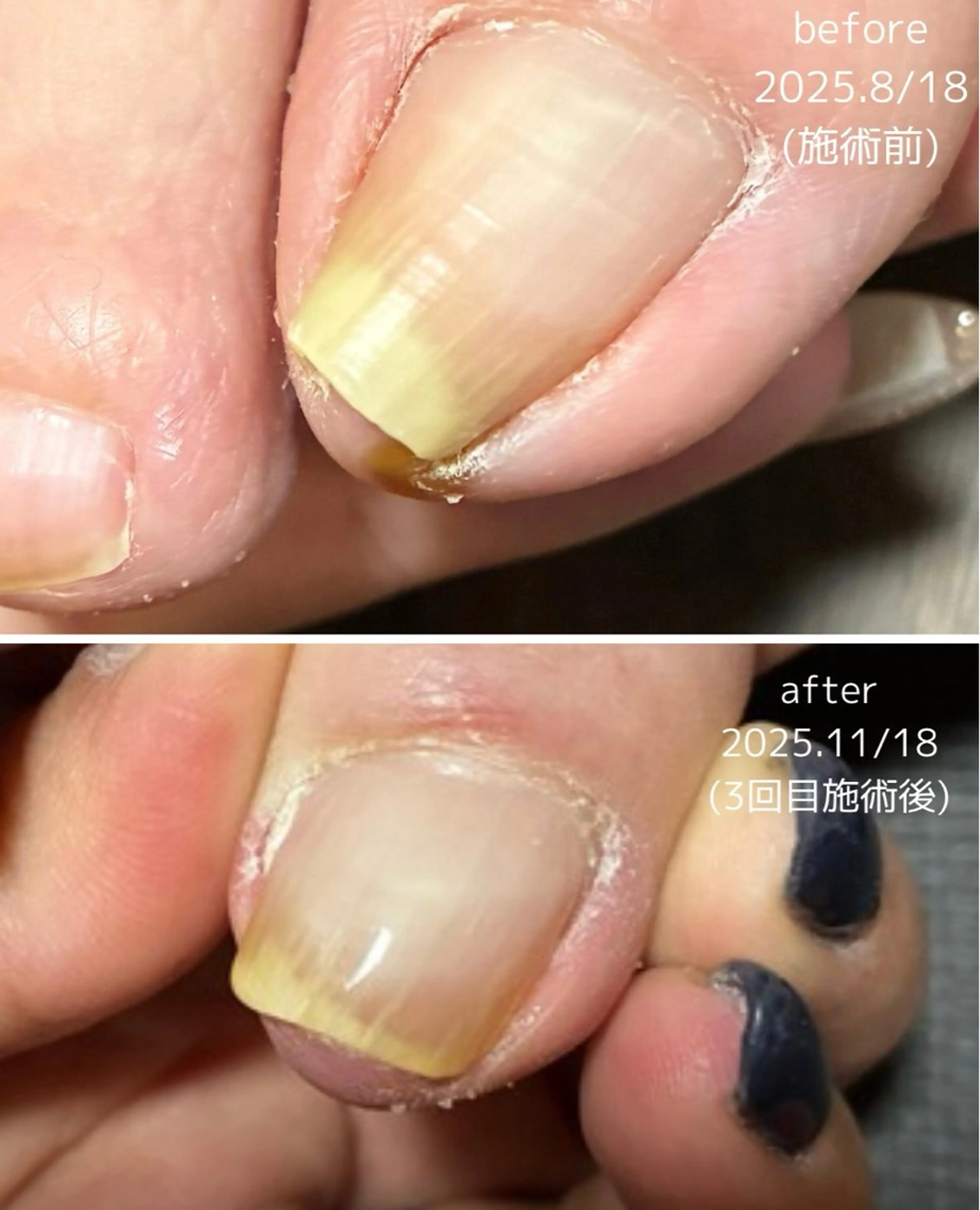 ネイル Li.m nail リム ネイルのネイルデザイン