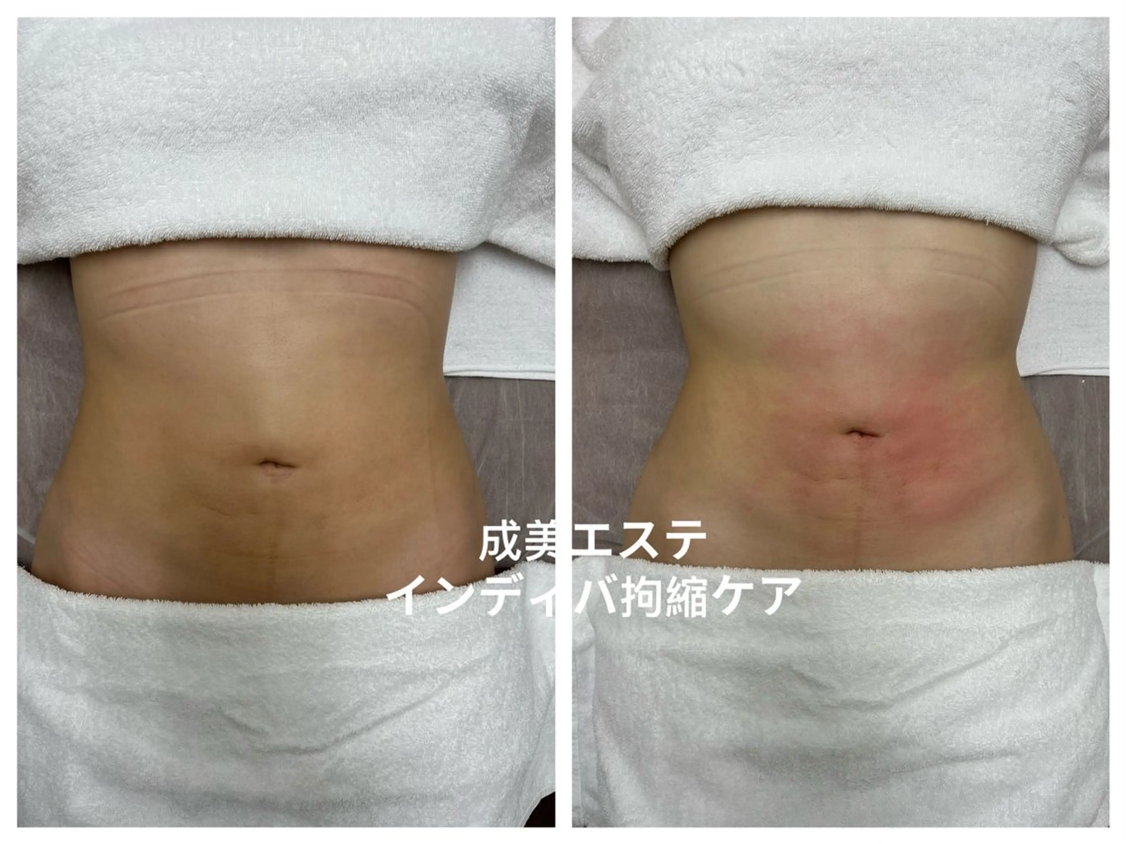 新大久保成美 エステ(エリカ)のエステ・リラクイメージ