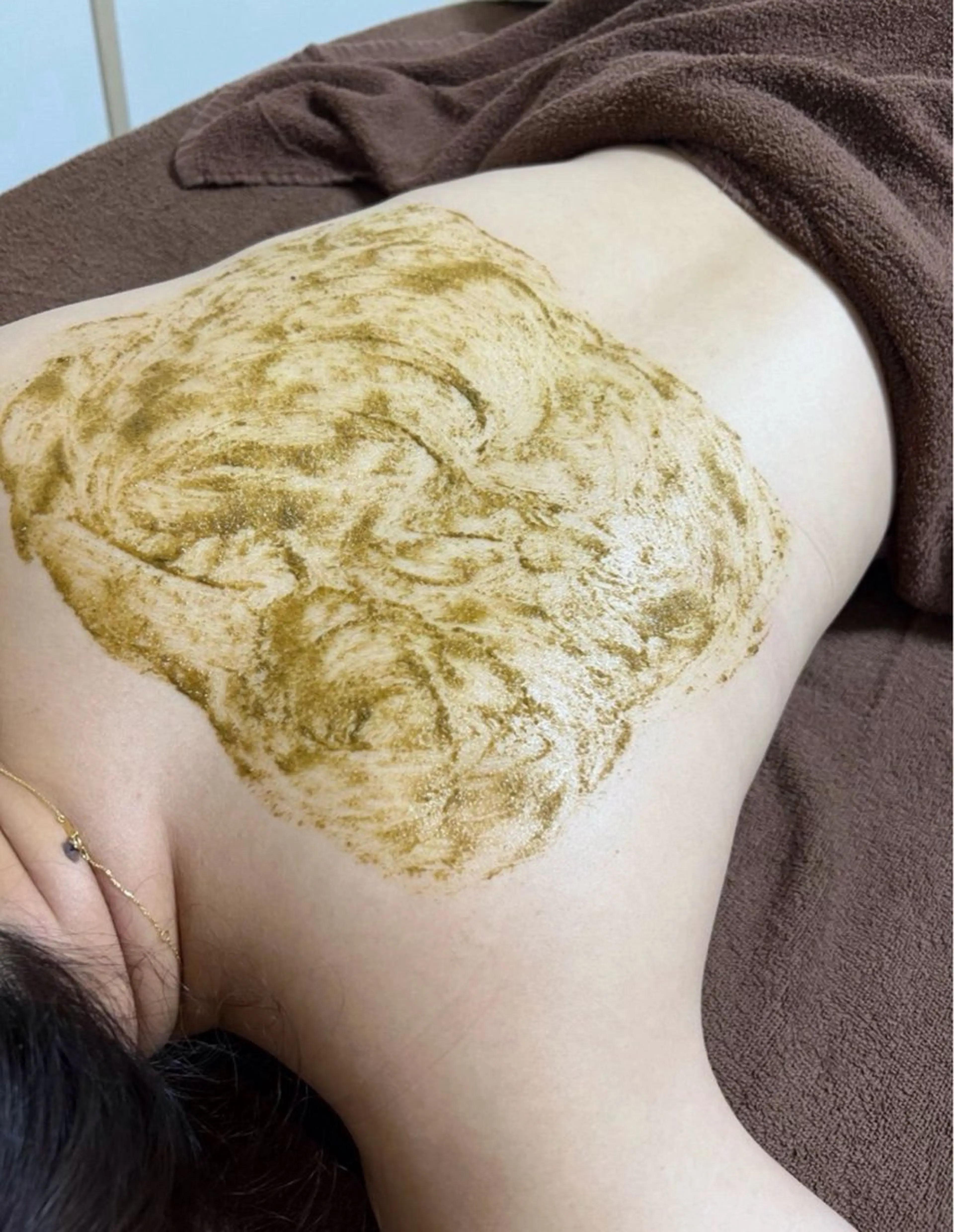 【背中ニキビ】背中ハーブピーリング☆剥離ありorなし選択可能の写真