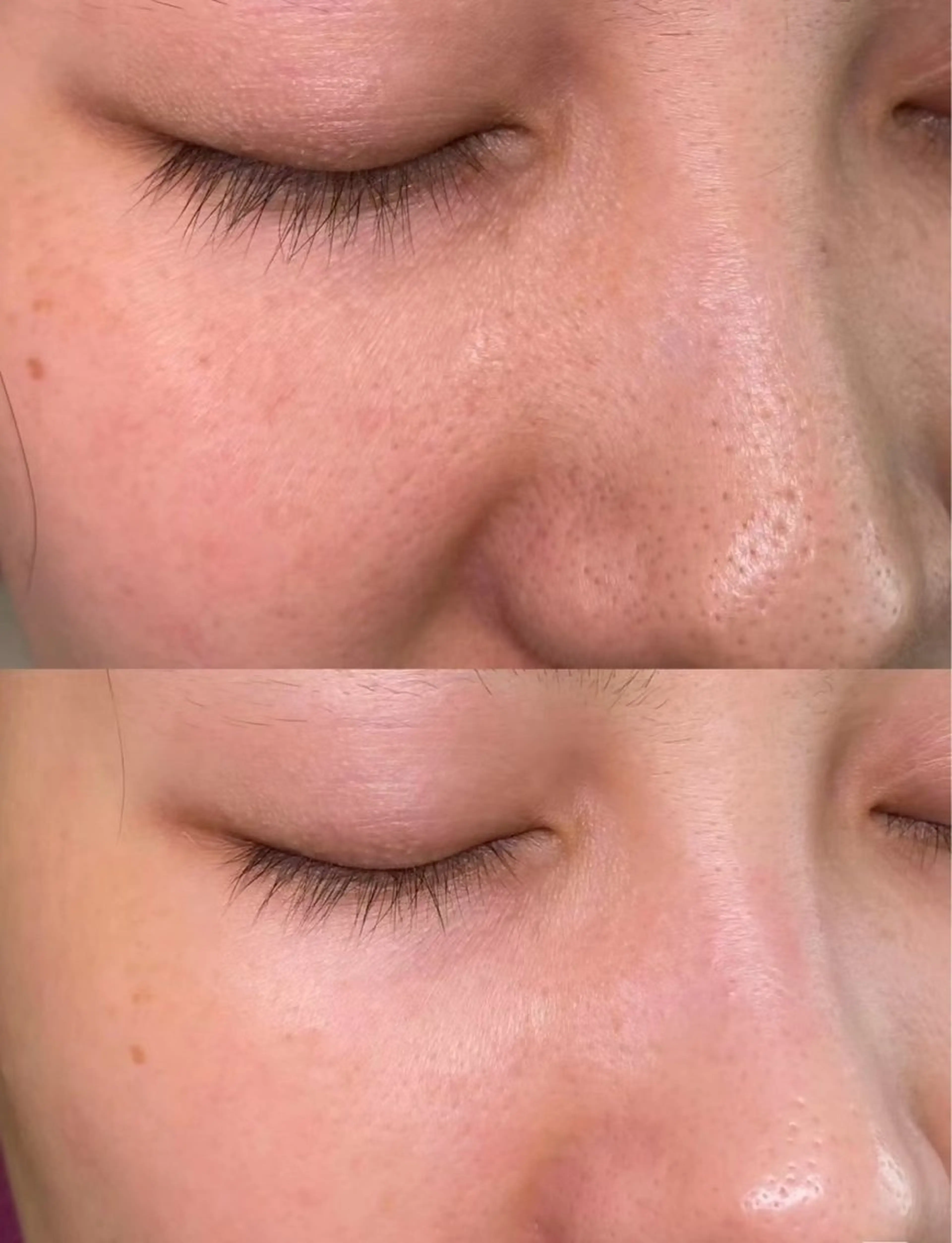 マツエク・マツパ 結婚式・ブライダル エステ 愛維美水光美肌専門店所属・愛維美水光美肌専門店 メンズレディースokのエステ・リラクイメージ