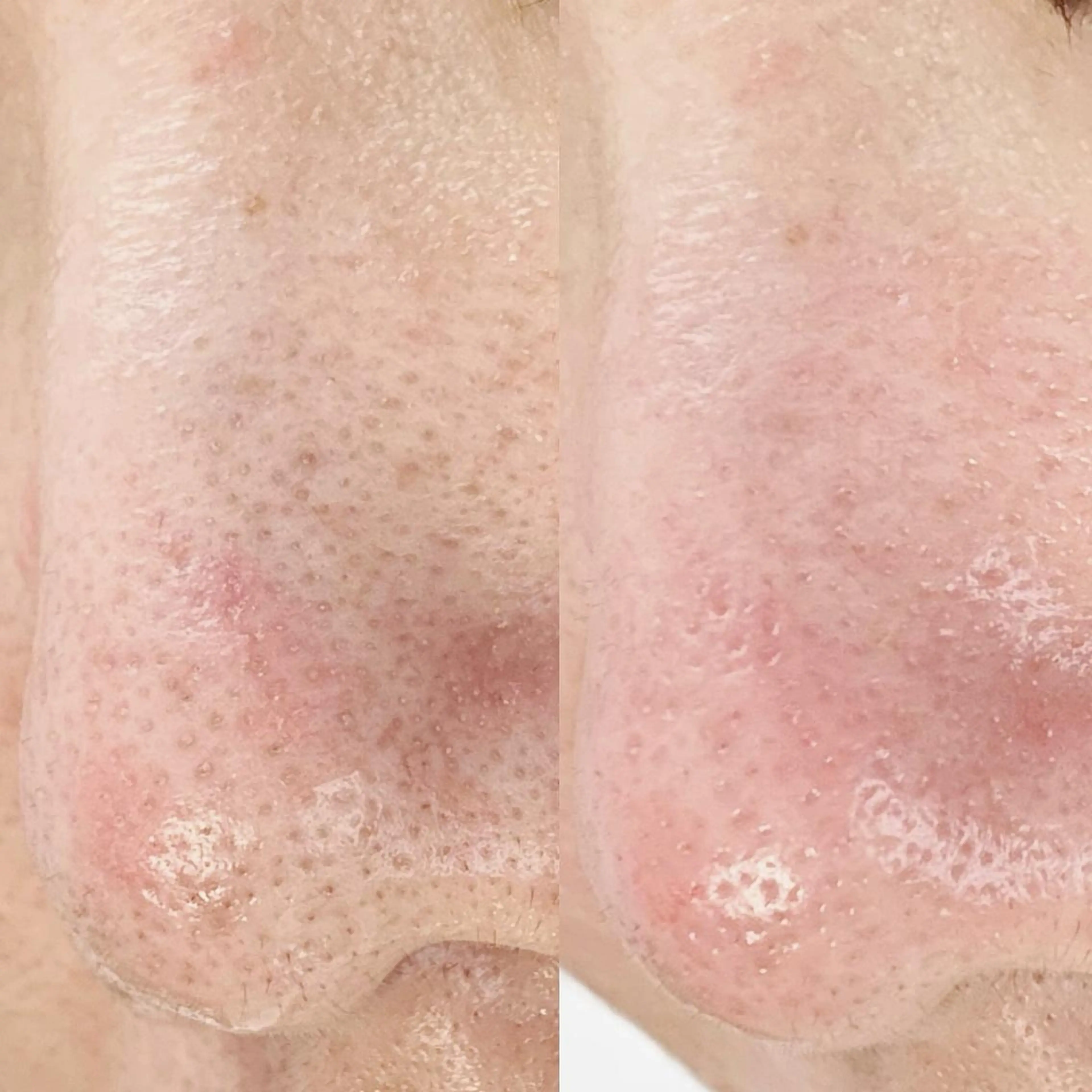 メンズ エステ salonLADYSTYLE所属・稲嶺 美華のエステ・リラクイメージ