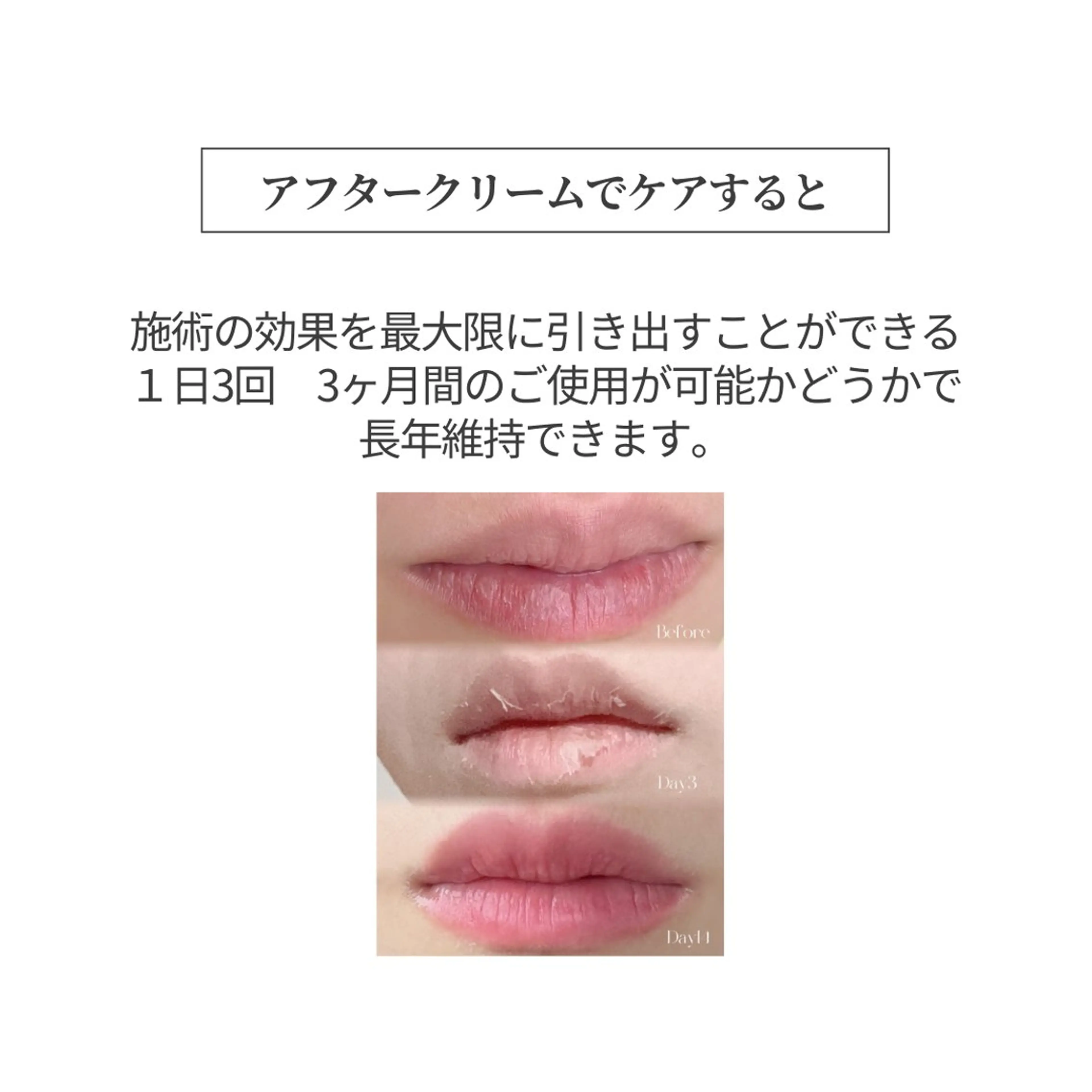 小顔/たるみ/黒ずみ除去専門サロン/SONA 大和西大寺店所属・【小顔専門看護師 サロンSONA】のエステ・リラクイメージ