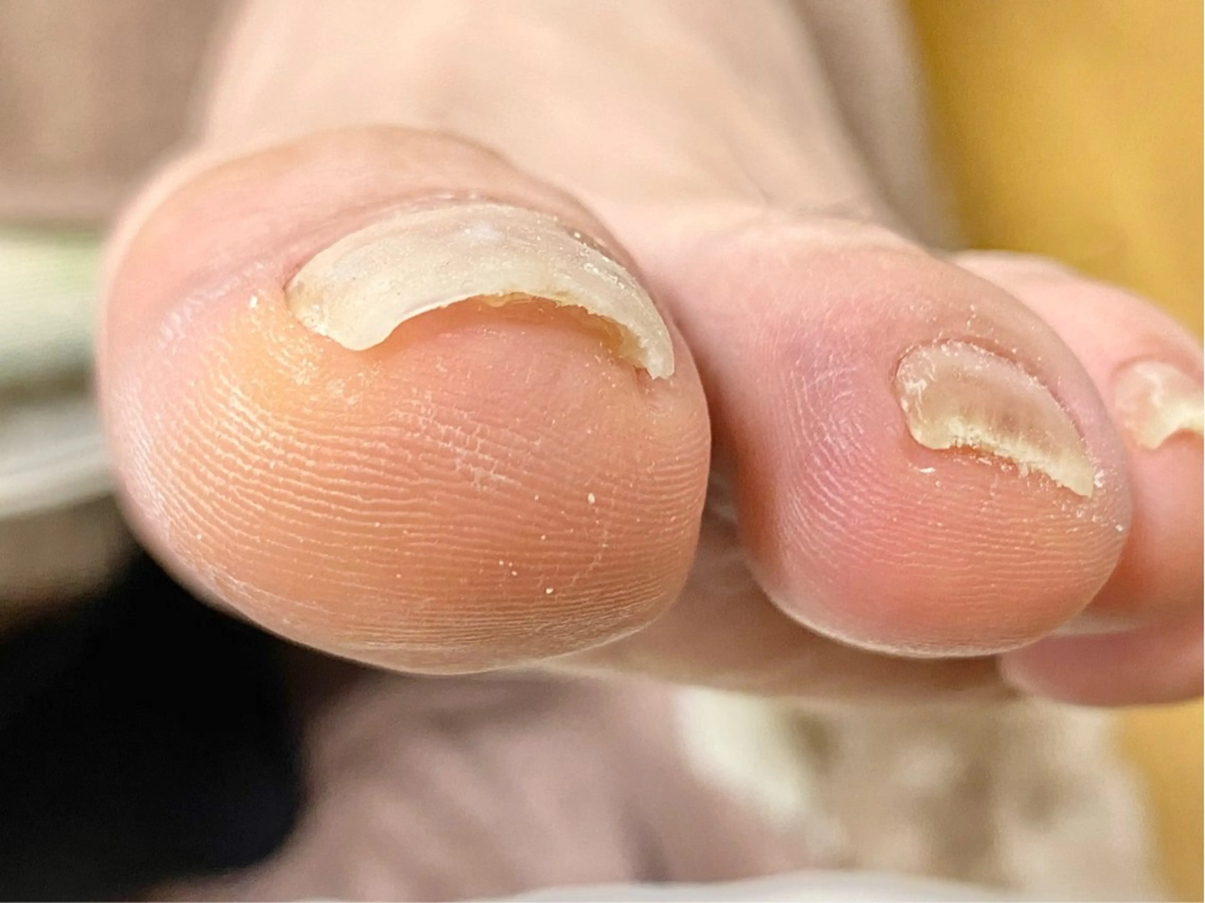 ネイル すこやかネイルサロン　めぐ所属・すこやかネイルサロン めぐのネイルデザイン